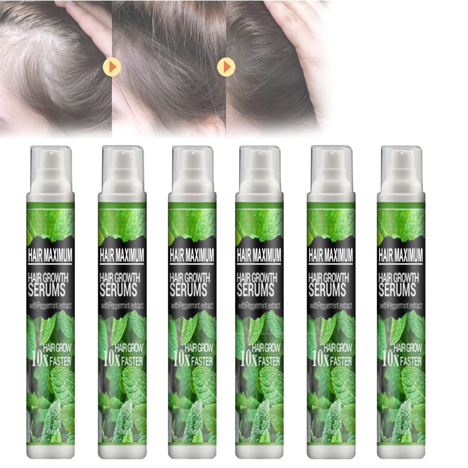 Herbal Hair Growth Essence Spray - Natural Hair Regrowth Treatment for Thinning Hair, Daily Nourishing Volumizing Spray (6 Pack) | Promotes Healthy Scalp & Stronger Hair for Men & Women, Perfect for Home & Salon Use