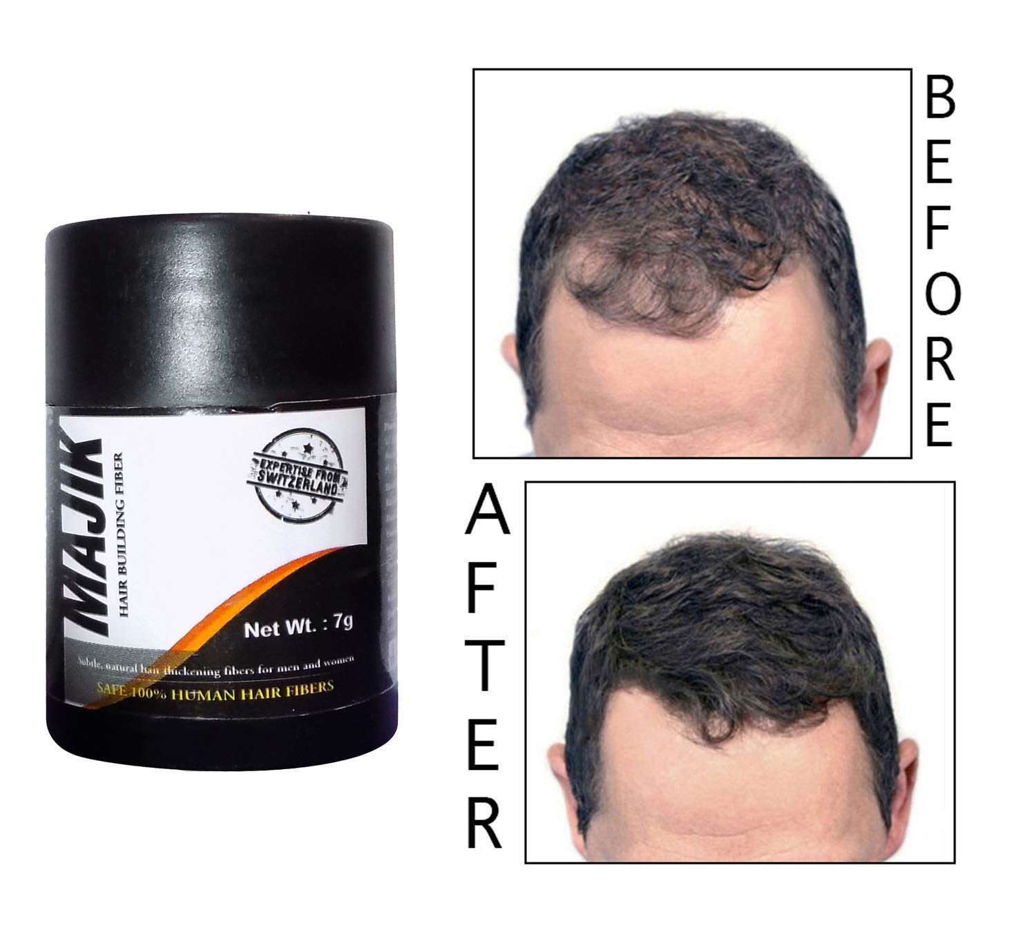 Inaaya Hair Concealer Treatment - Dark Brown Hair Fibers for Men & Women (7g) | Covers Thinning Hair & Bald Spots for Natural Look - Perfect for Daily Use & Special Occasions