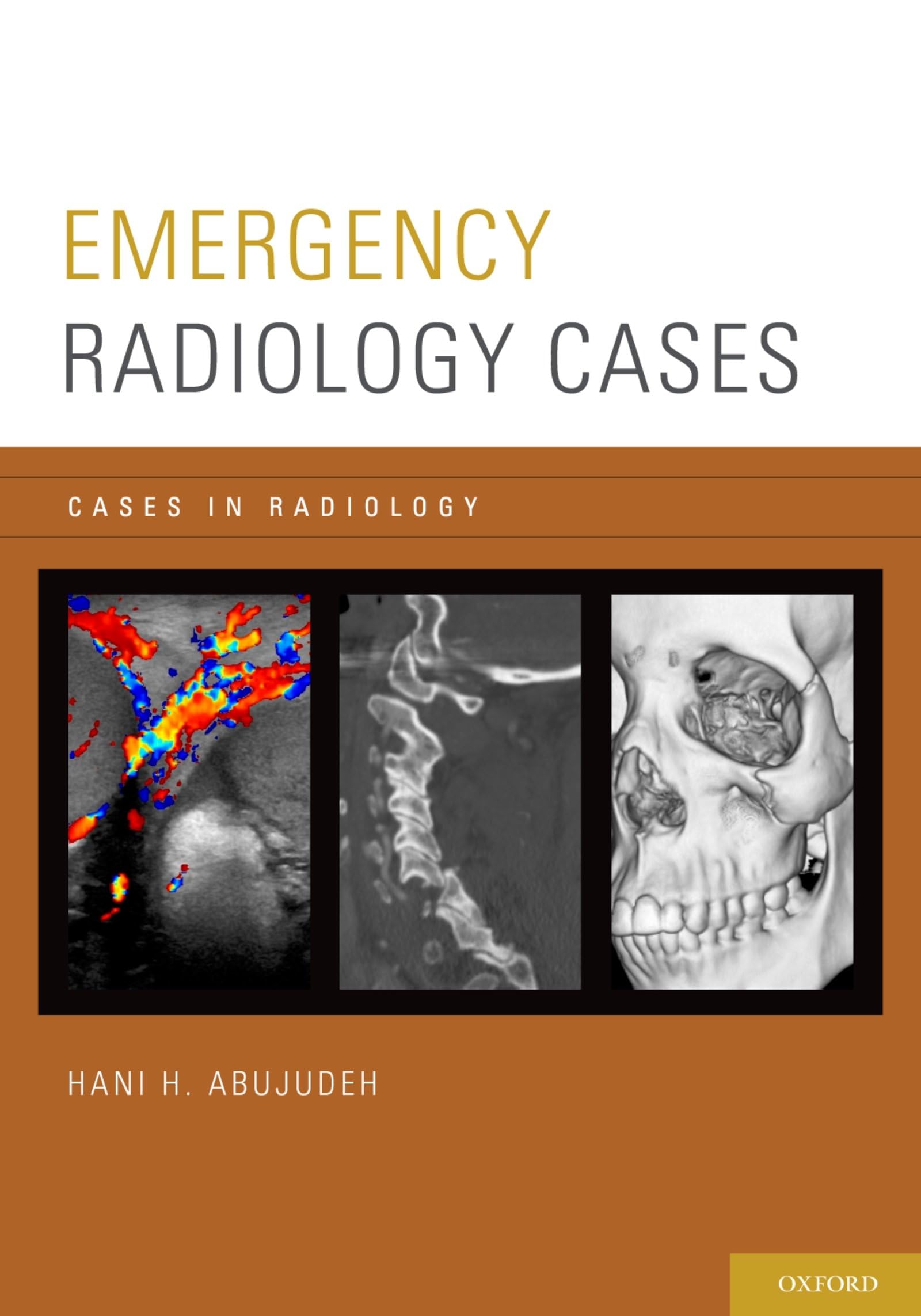Emergency Radiology Cases: Essential Diagnostic Imaging Scenarios for ER & Trauma Care – Perfect for Medical Students & Radiologists