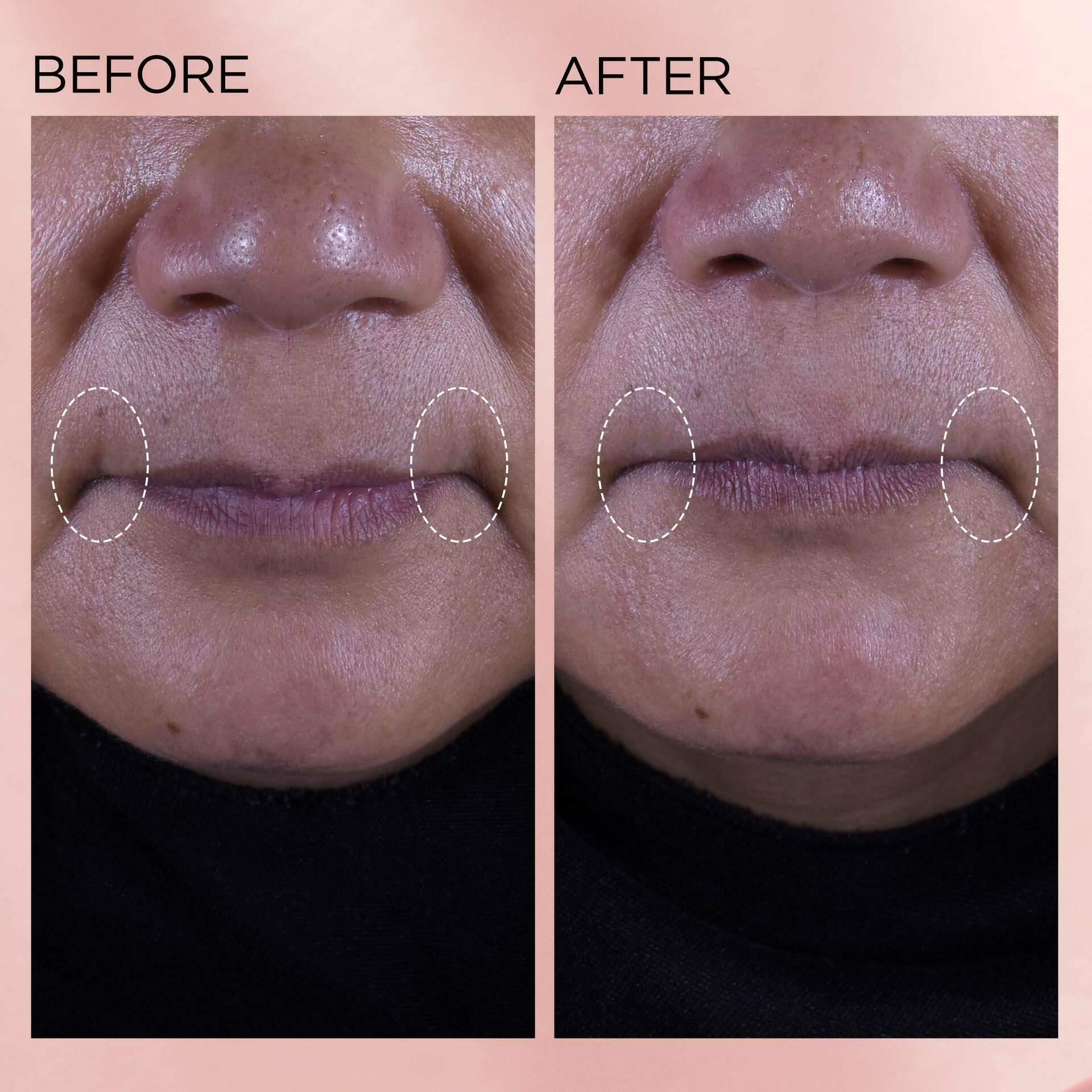 Retinol + HPR Ceramide Moisturizing Face Cream for Wrinkles & Dry Skin - Anti-Aging Night Cream for Women & Men - Hydrating Skincare for Face, Neck & Décolleté