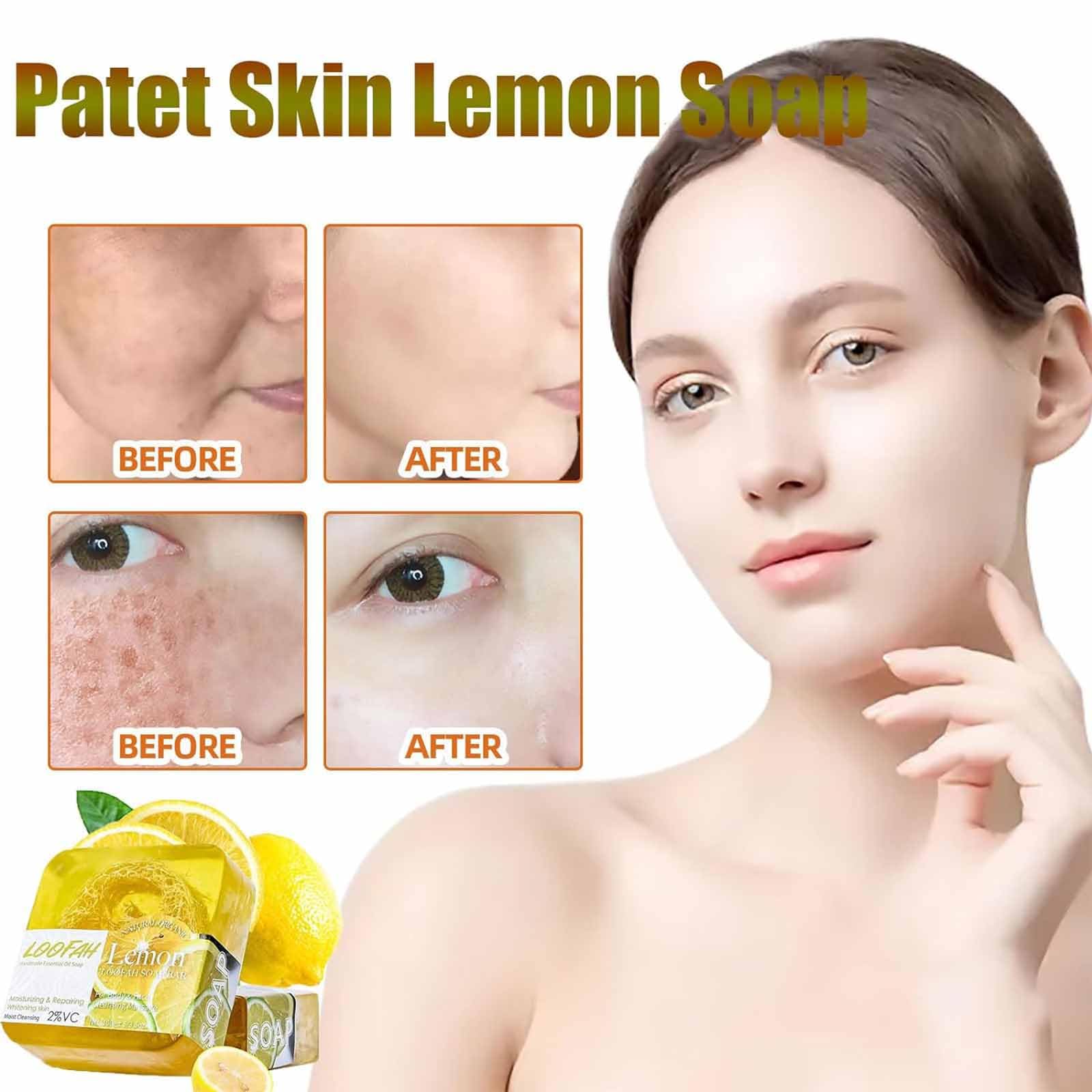 FUUZIO 2-Pack Patet Skin Brightening Lemon Soap Bar with Essential Oils - Exfoliating & Moisturizing Face & Body Cleanser for Glowing Skin - Perfect for Daily Skincare Routine & Spa Treatments