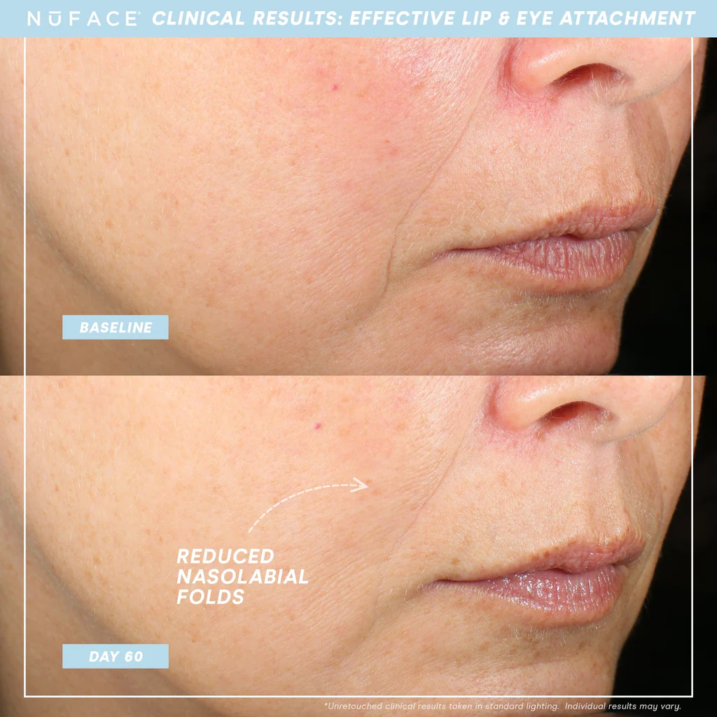 NuFACE Trinity Facial Toning Device with Lip & Eye Attachments - Anti-Aging Microcurrent Skincare for Wrinkle Reduction & Firming - Perfect for Home Use & Travel Beauty Routine