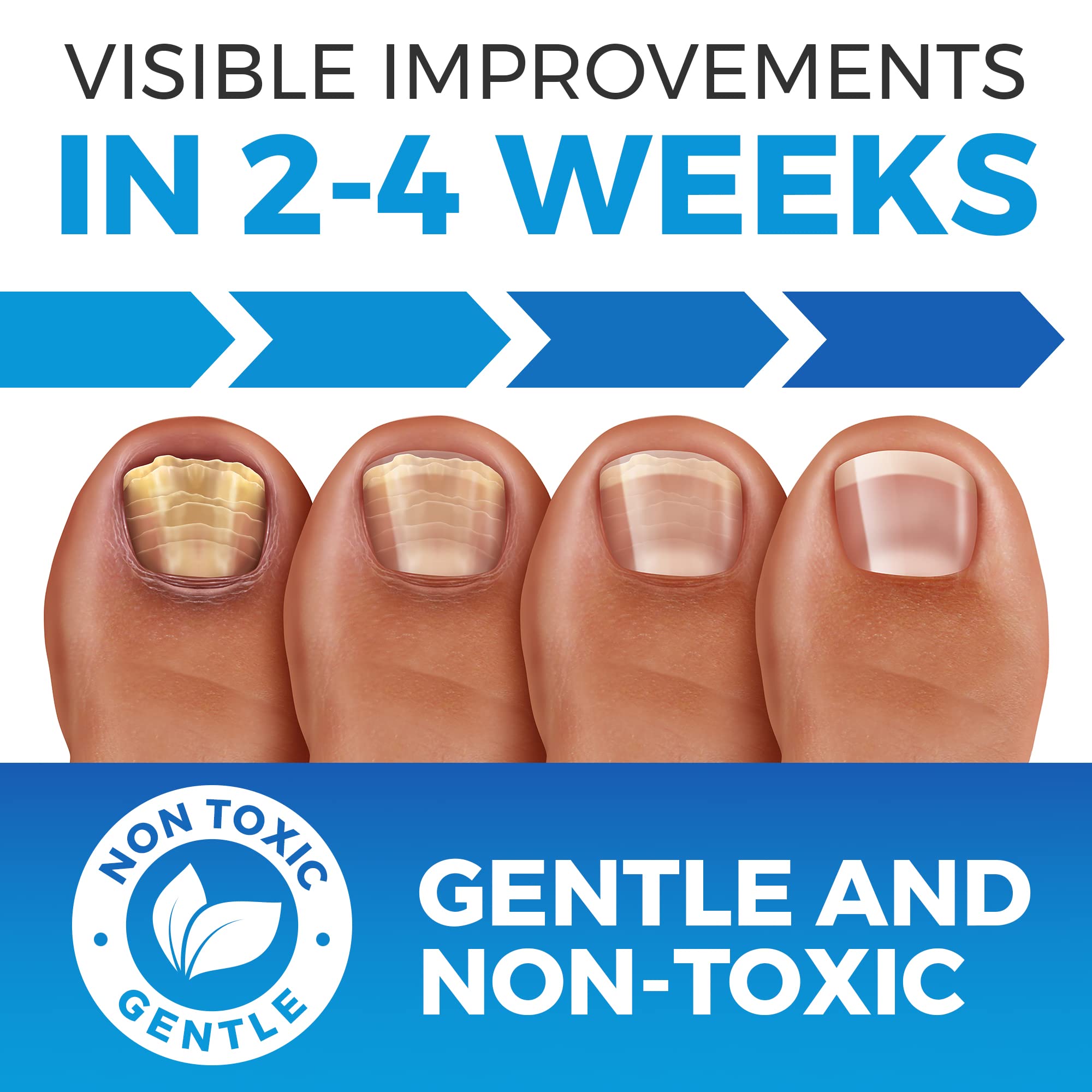 Best Fungal Nail Treatment with Antifungal Nail Polish in Red - Effective Toenail & Fingernail Repair for Discolored, Thickened Nails - Perfect for Daily Use at Home, Salon, or On-The-Go