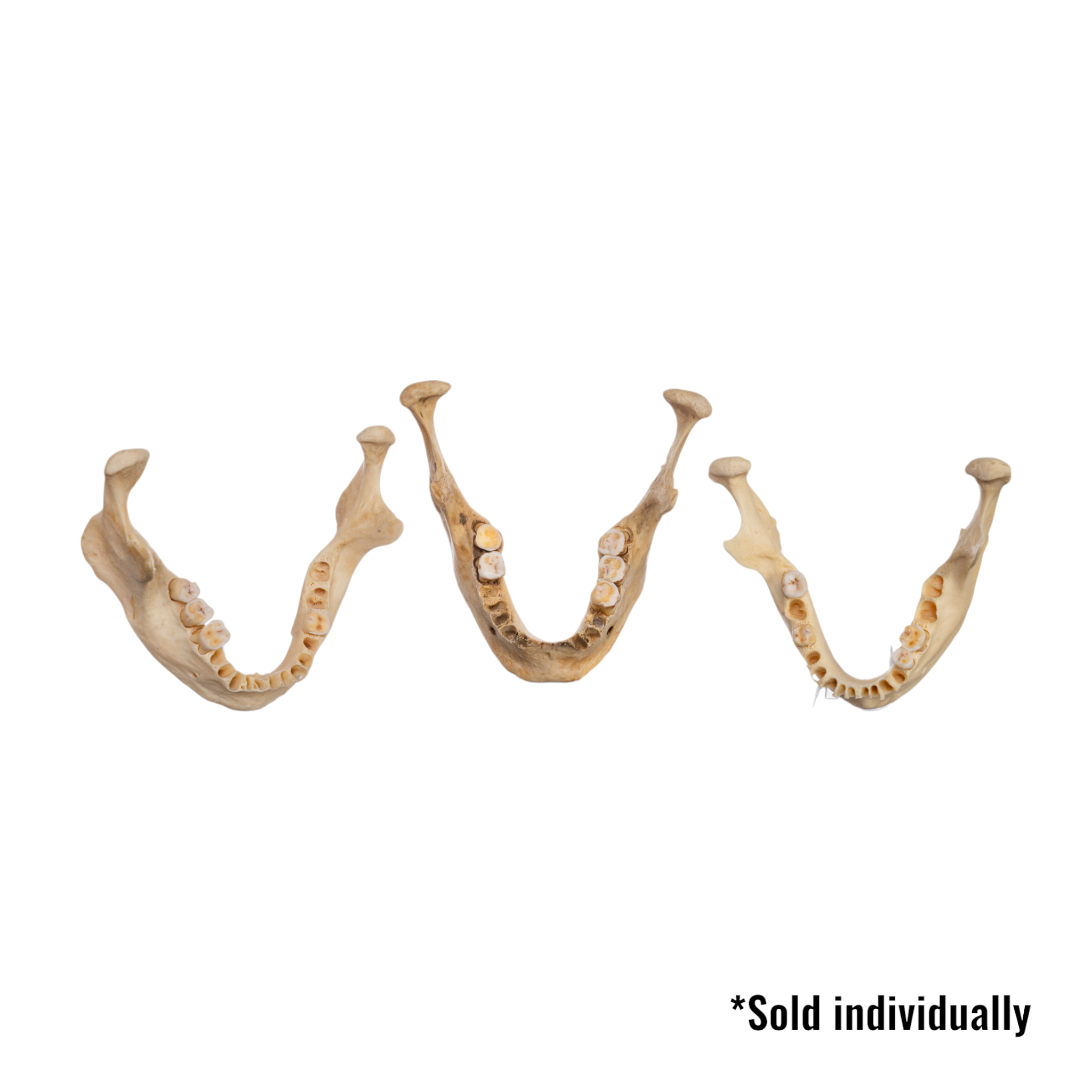 Authentic Human Mandible Bone - Single Specimen for Medical Study, Dental Education & Anatomy Research