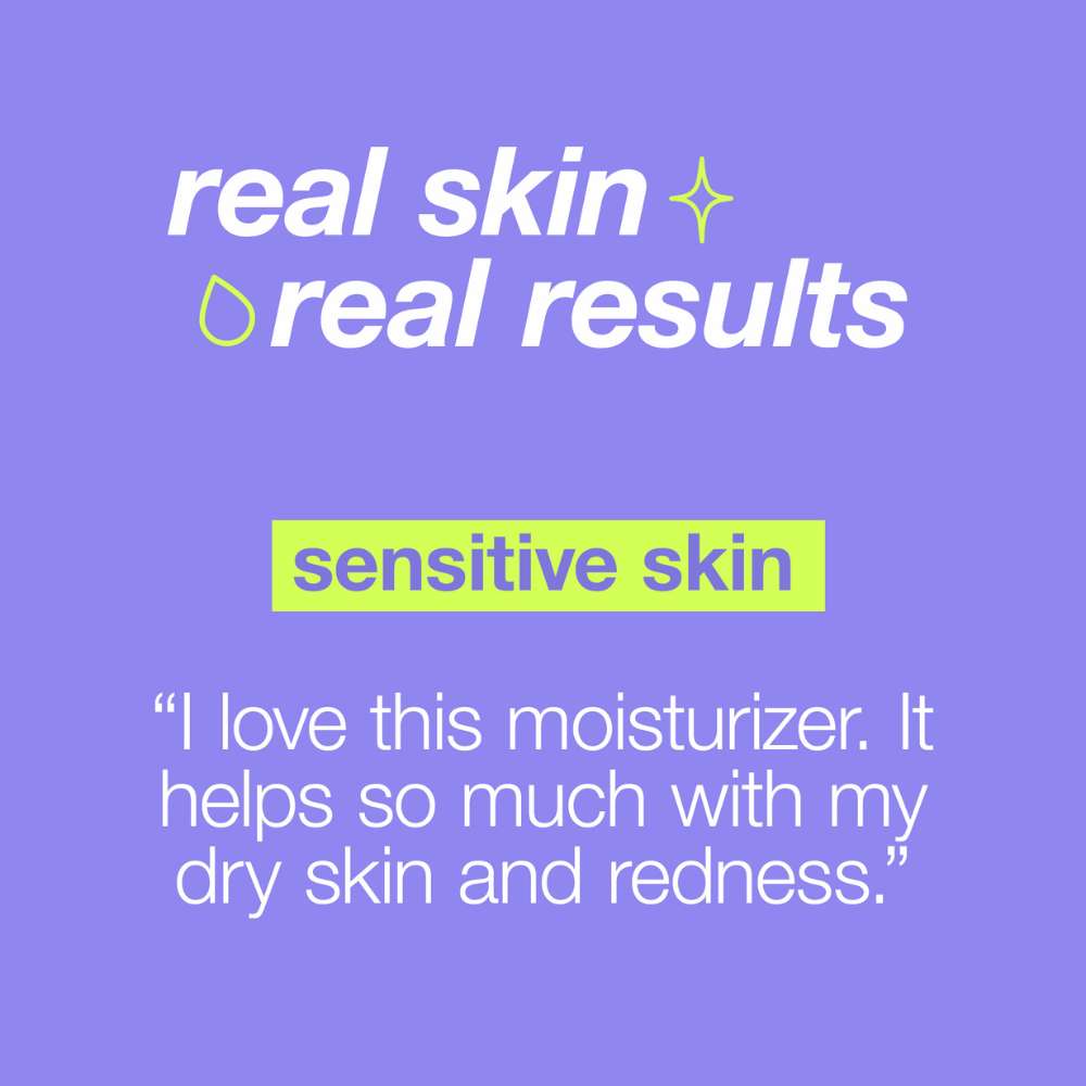 Soothing & Hydrating Lotion for Dry Skin - Moisturizing Body Lotion with Aloe Vera & Vitamin E for Sensitive Skin Care - Perfect for Daily Use After Shower or Sun Exposure