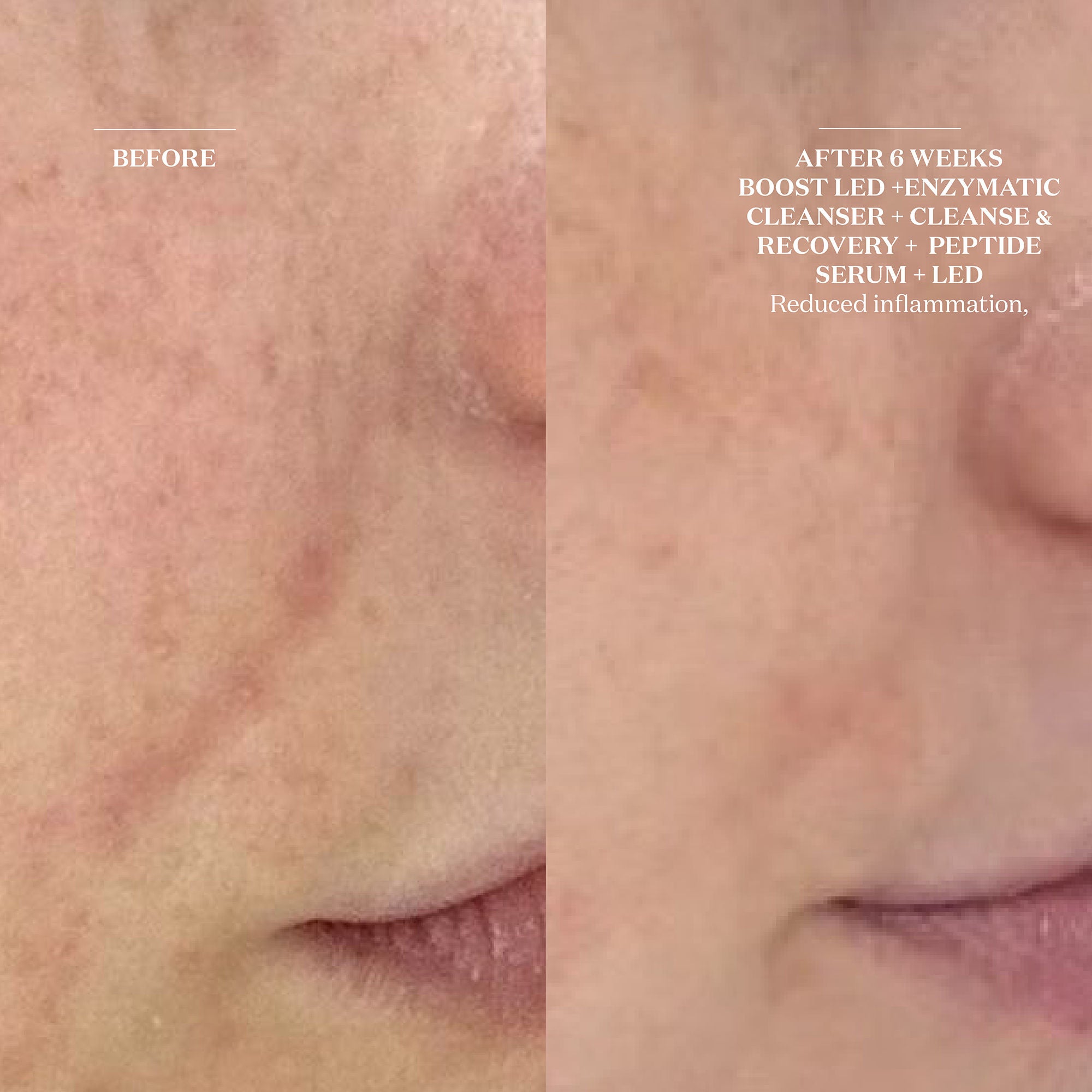 Cleanse & Recovery Spray - Hydrating Facial Mist for Skin Refresh & Rejuvenation | Perfect for Post-Workout, Travel & Daily Skincare Routine