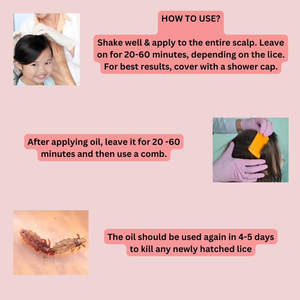 Amalun Lice Removal Oil - Fast-Acting Natural Treatment for Head Lice, Nits & Scalp Care | Safe for Kids & Adults | Perfect for Home Use & School Prevention