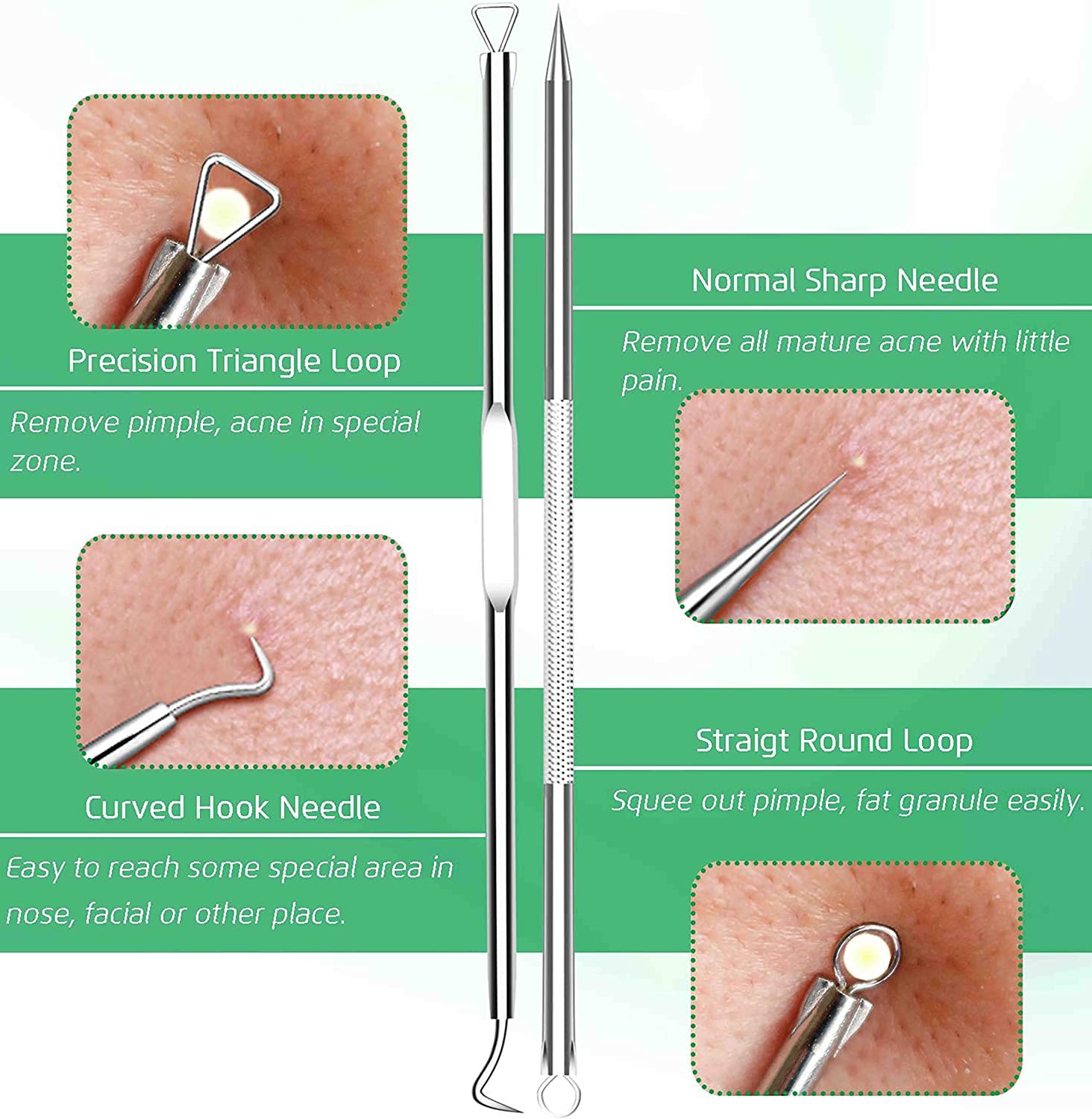Professional Blackhead Remover Kit - 4 Pcs Pimple Comedone Extractor Tools with Case for Whitehead & Blemish Treatment | Safe for Nose & Face Skin | Perfect for Home Spa, Acne Care & Skincare Routine