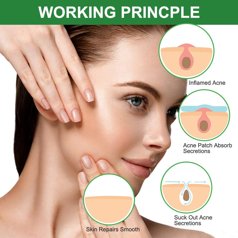 Mluffy 36Pcs Invisible Acne Pimple Patches - Hydrocolloid Spot Treatment Stickers for Face, Absorbing Blemish & Scar Care, Waterproof Transparent Pimple Patch Sheets for Clear Skin (Pack of 1) | Perfect for Overnight Spot Treatment, Teen & Adult Acne Care, Travel-Friendly Skin Solution