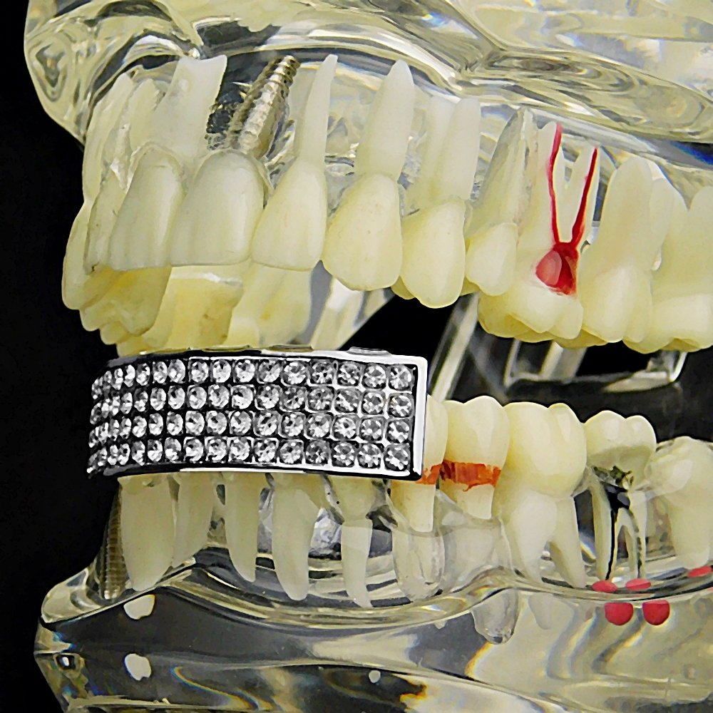 4 Row Silver Tone Hip Hop Grillz for Lower Teeth - Bling Mouth Jewelry for Men & Women - Perfect for Parties, Concerts & Rap Performances