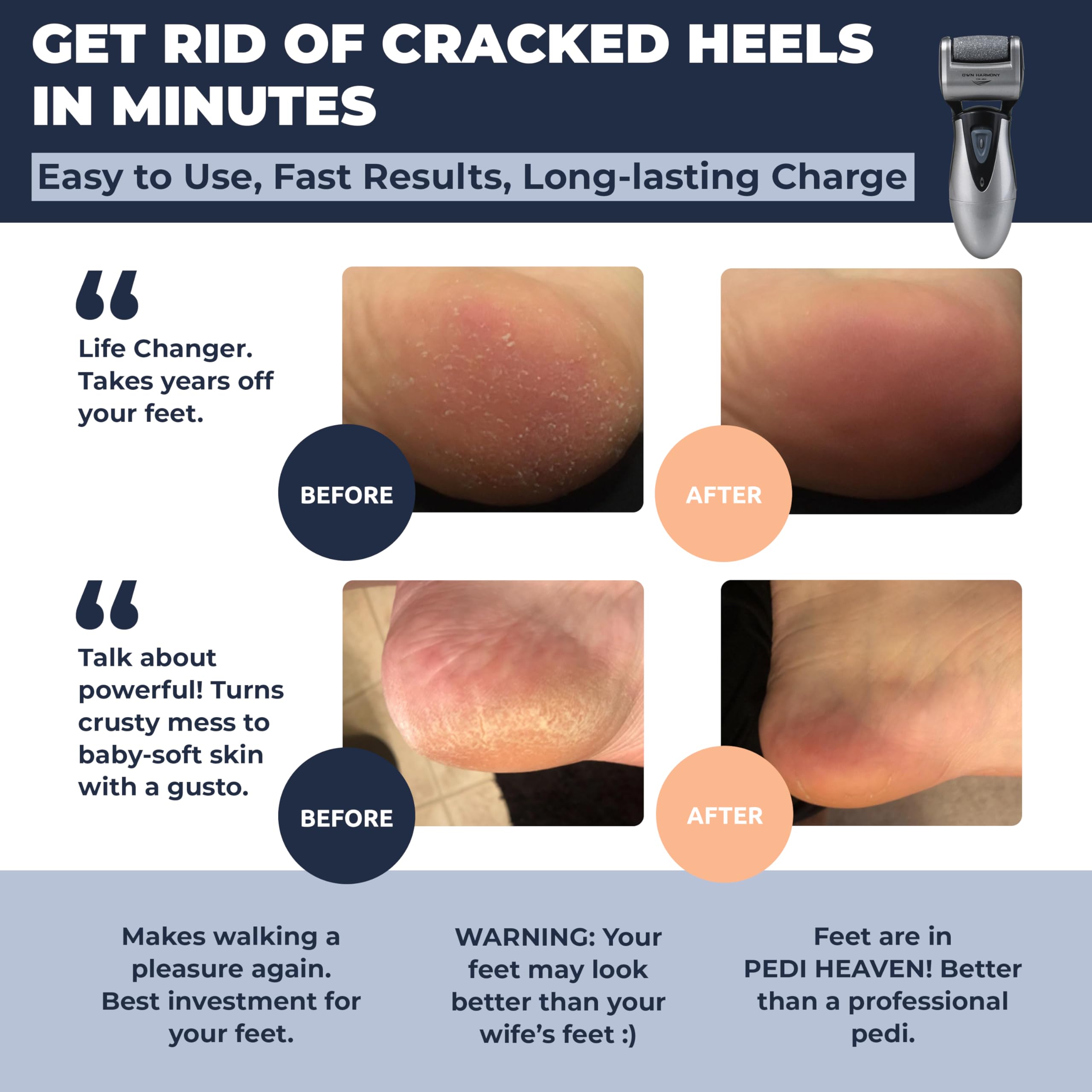 Own Harmony CR900 Electric Callus Remover - Rechargeable Professional Foot File with 3 Rollers for Cracked Heels & Hard Skin | Most Powerful Pedicure Tool for At-Home Foot Care & Spa Treatments