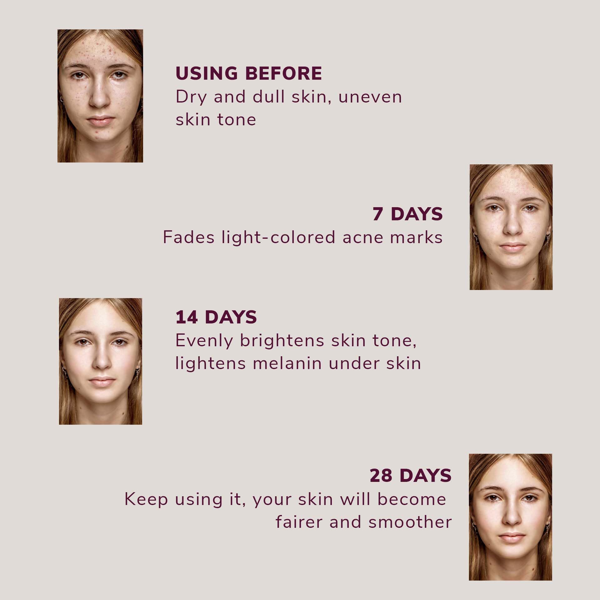 Iuvenis Veda 20% Vitamin C Face Serum for Glowing Skin - Sensitive Skin Friendly, Highly Stable & Non-Irritating Formula | Brightening & Hydrating Vitamin C Serum for Men & Women (30ml) | Perfect for Daily Skincare Routine & Anti-Aging Treatment