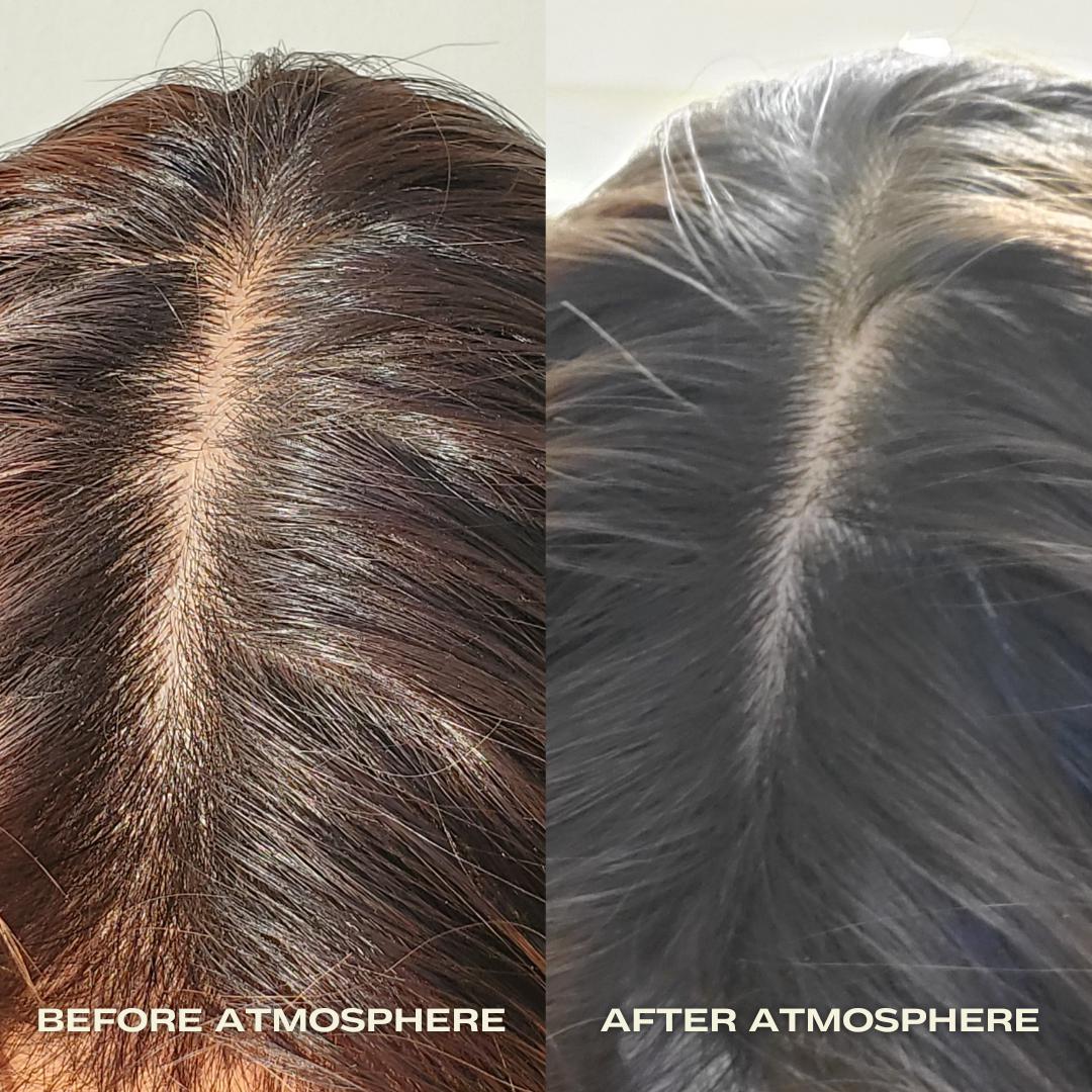 Atmosphere Hair Density & Scalp Serum for Thicker Hair Growth - Natural Hair Loss Treatment & Scalp Care Solution for Men & Women - Perfect for Daily Use & Hair Regrowth Routine
