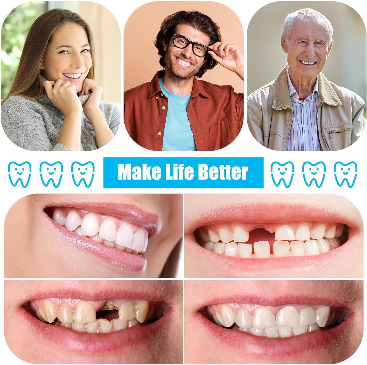 DIY Denture Kit - Full Set of Top & Bottom Fake Teeth for Missing Teeth Repair & Smile Enhancement | Easy & Convenient at Home | Perfect for Cosplay, Halloween, Costume Parties & Dental Emergencies
