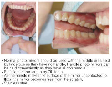 OSUNG Dental Mirror with Handle - Intraoral Photography & Occlusal Examination Tool for Dentists, Hygienists & Dental Students - Perfect for Oral Exams, Photography & Clinical Training