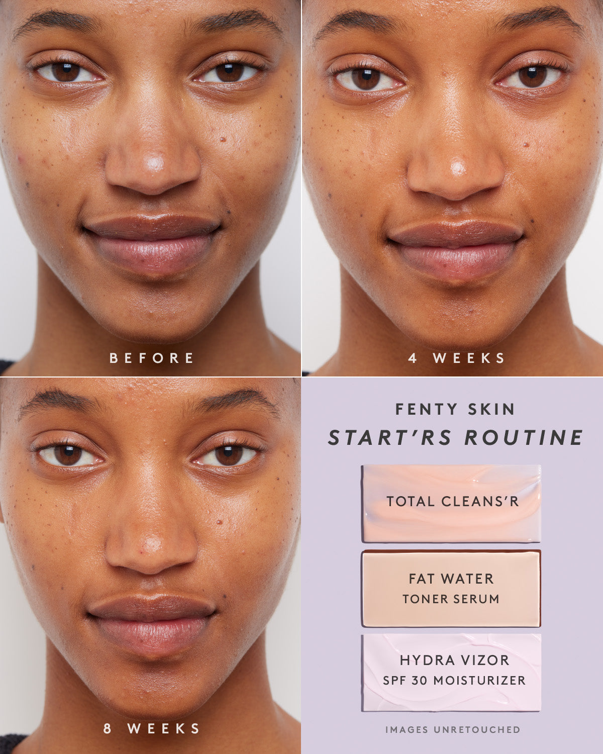 Niacinamide Pore Refining Toner Serum with Barbados Cherry | Fragrance Free Fat Water | Brightening & Hydrating Facial Treatment for Oily & Combination Skin | Perfect for Daily Skincare Routine & Pore Minimizing