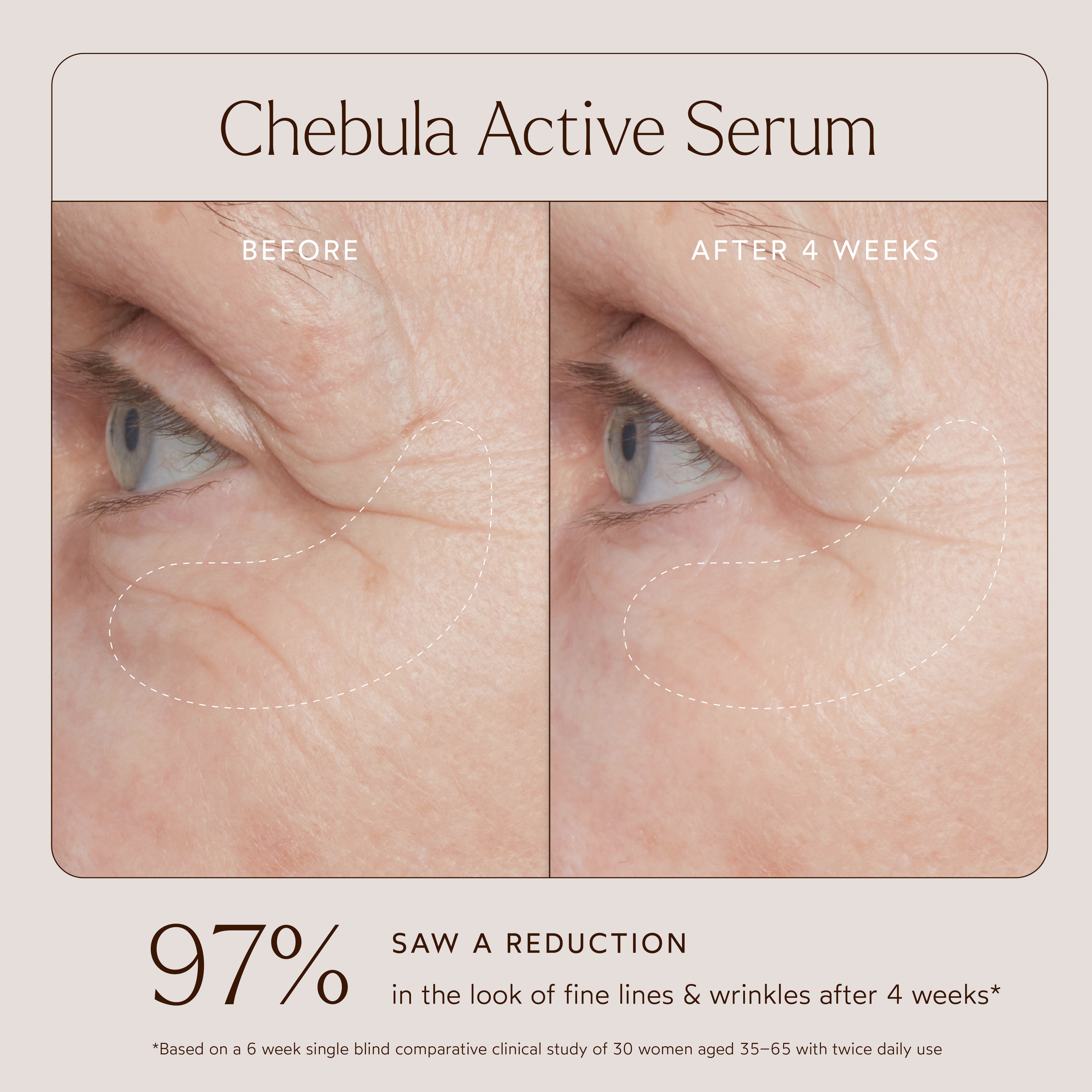 Chebula Active Anti-Aging Serum for Face - Organic Wrinkle Treatment & Skin Tightening Cream - Best for Night Routine, Dry Skin Care & Mature Skin Rejuvenation