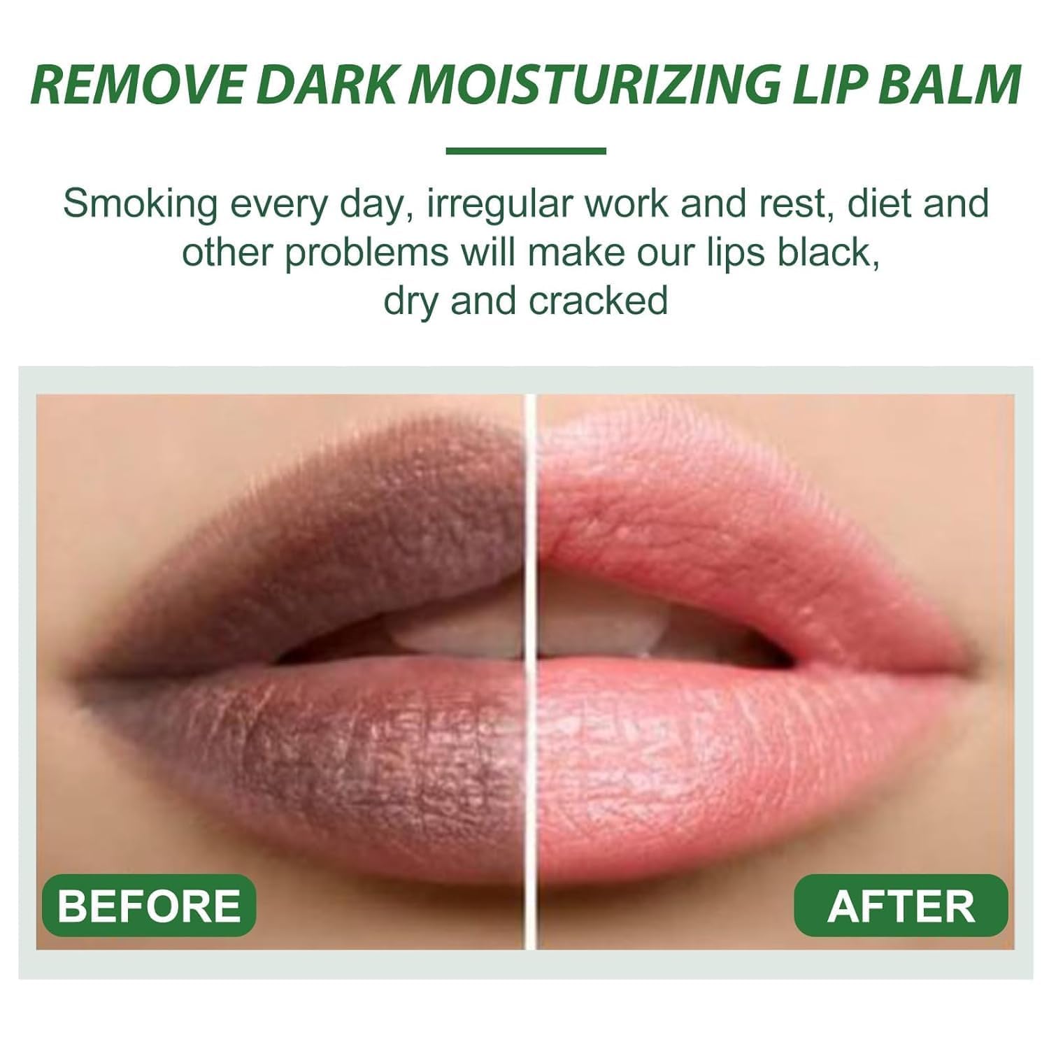 Dark Lip Balm for Lip Lightening & Pigment Removal - Shea Butter Lip Care to Exfoliate Dead Skin & Brighten Dark Lips (3Pcs) - Perfect for Daily Lip Care & Nighttime Treatment