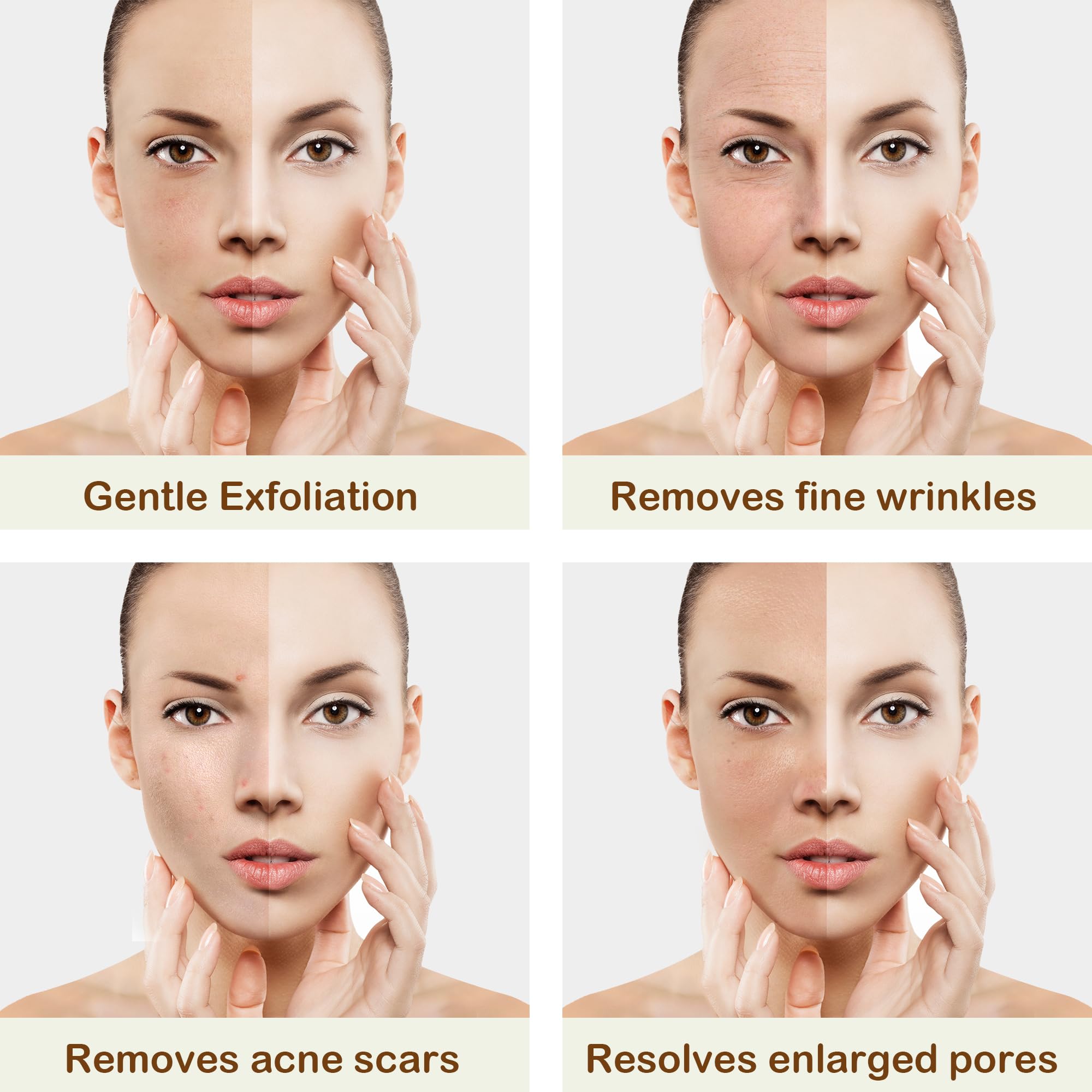 Professional Diamond Microdermabrasion Machine - 3 in 1 Skin Exfoliator & Rejuvenation Device for Face & Body | At-Home Spa Treatment, Anti-Aging & Acne Scar Removal
