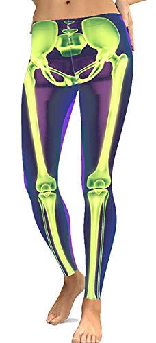 Bones-3