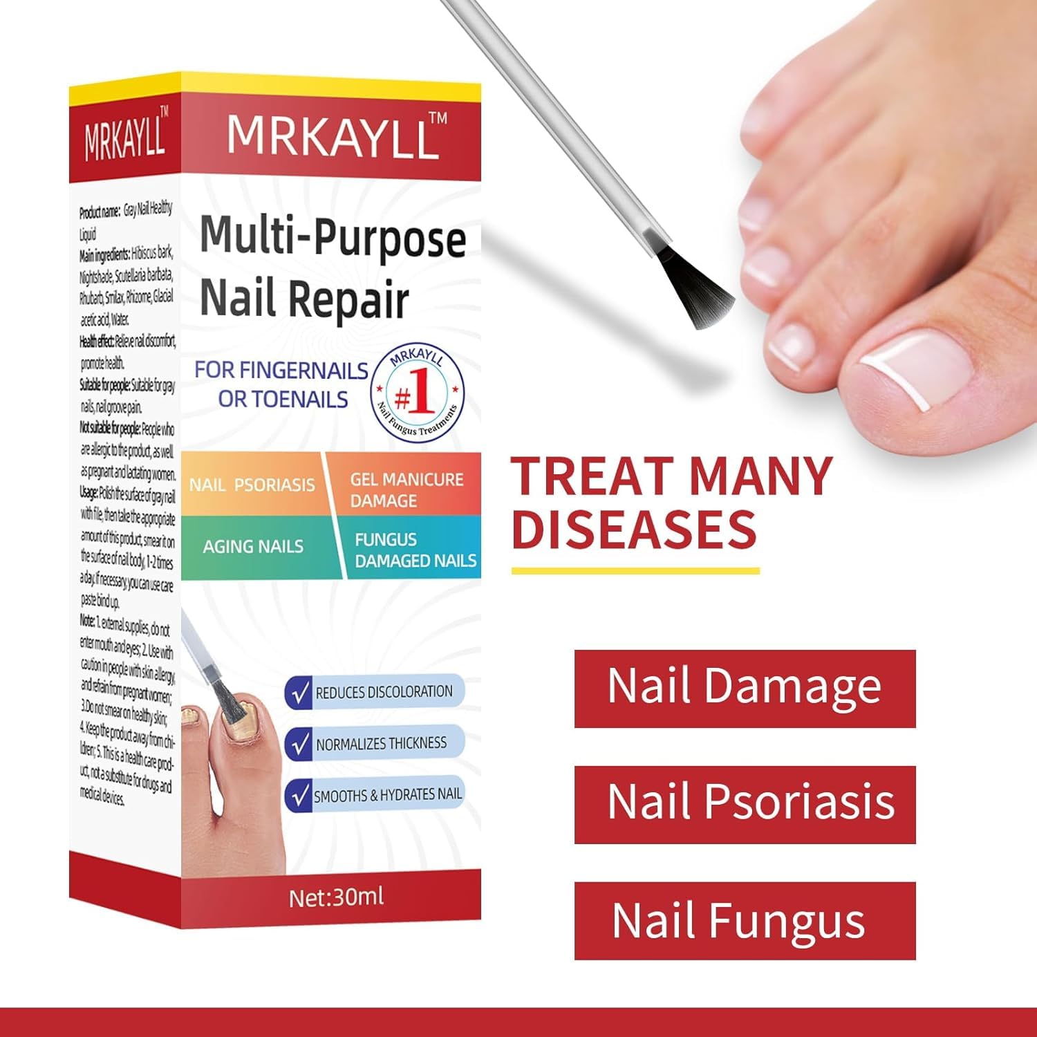 Extra Strength Toenail Fungus Treatment - Fast Acting Antifungal Solution for Toenails & Fingernails | 30ML (1 FLOZ) | Effective Remedy for Athlete's Foot & Nail Discoloration