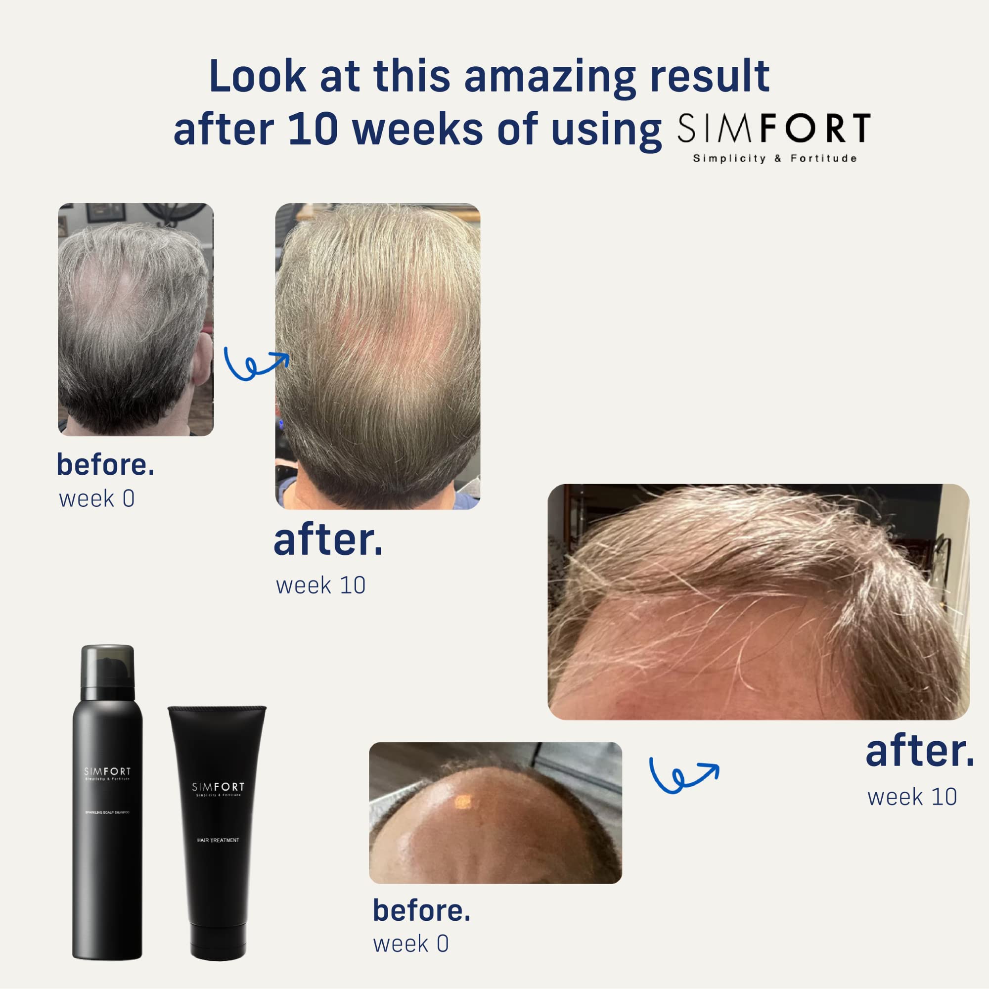 SPARKLING SCALP SHAMPOO & CONDITIONER SET for Thinning Hair & Hair Loss Treatment - Natural Hair Growth Kit for Women & Men | Daily Use for Stronger, Healthier Hair at Home or Salon