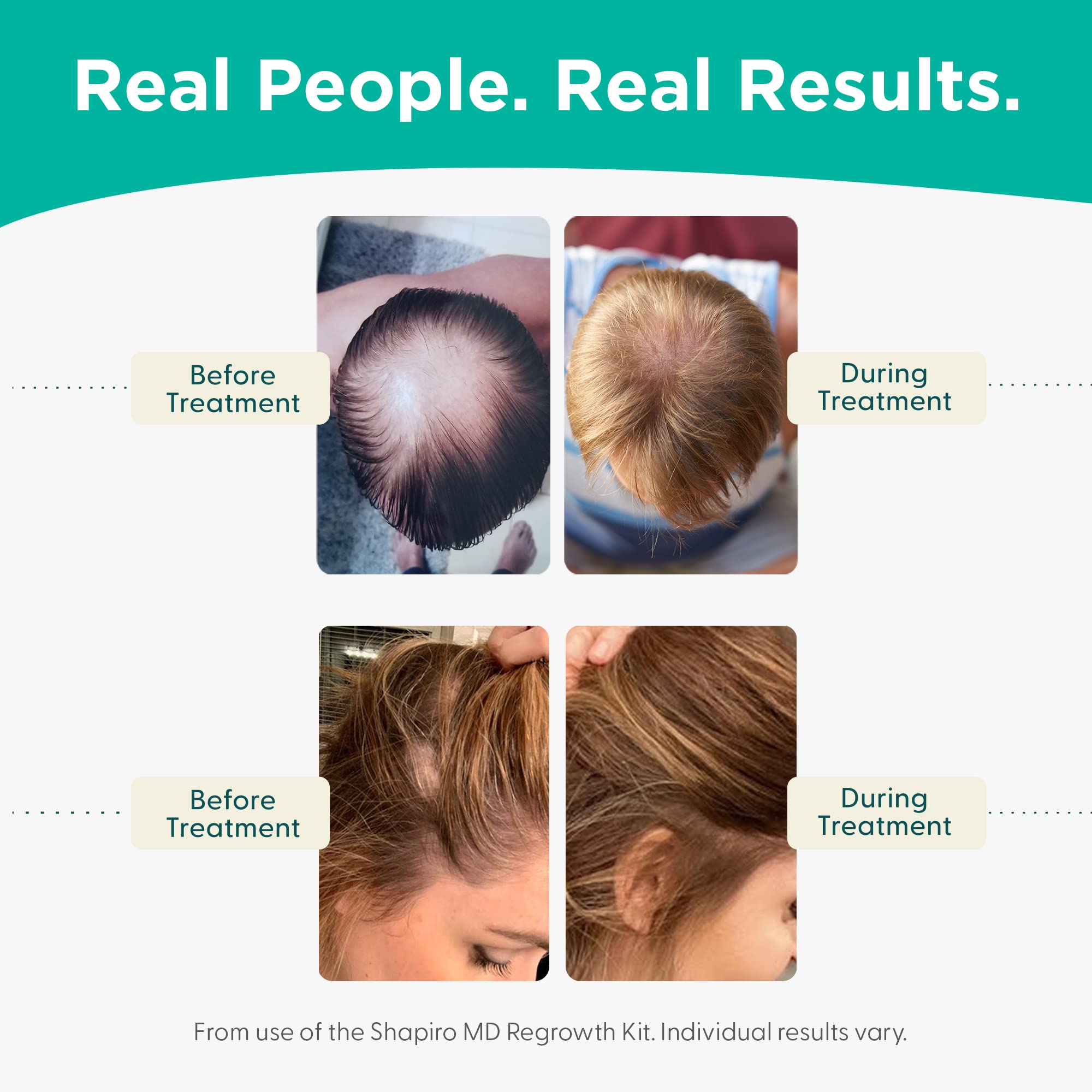 Shapiro MD Inner Wellness Trio - Collagen Powder, Daily Vitamins & Prebiotic Formula for Strong, Healthy Hair Growth | Dermatologist-Recommended Hair Supplements | Supports Scalp Health & Thicker Hair for Men & Women | Perfect for Daily Hair Care Routine & Post-Treatment Recovery