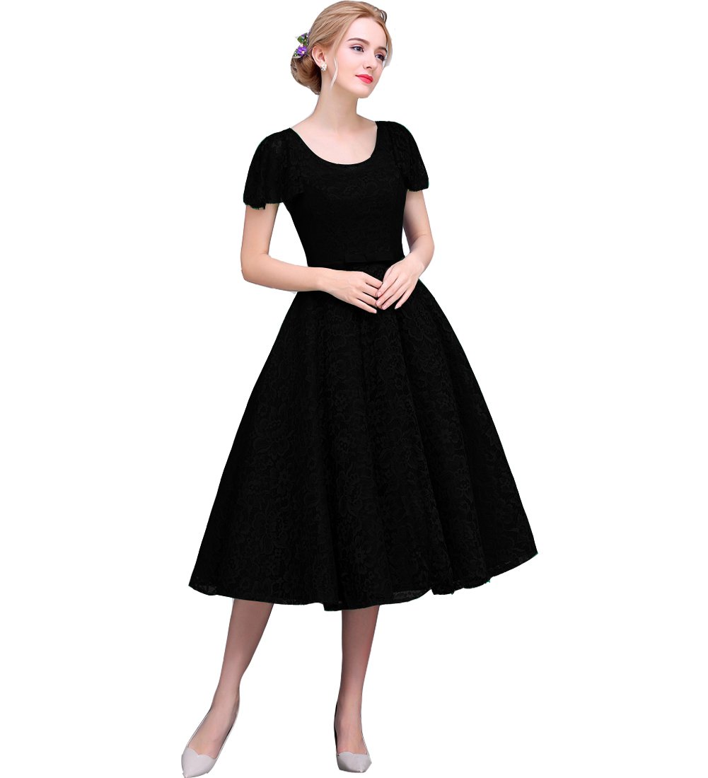 Vintage Lace Tea-Length Corset Dress for Prom, Homecoming & Evening Events – Elegant Short Formal Gown for Special Occasions
