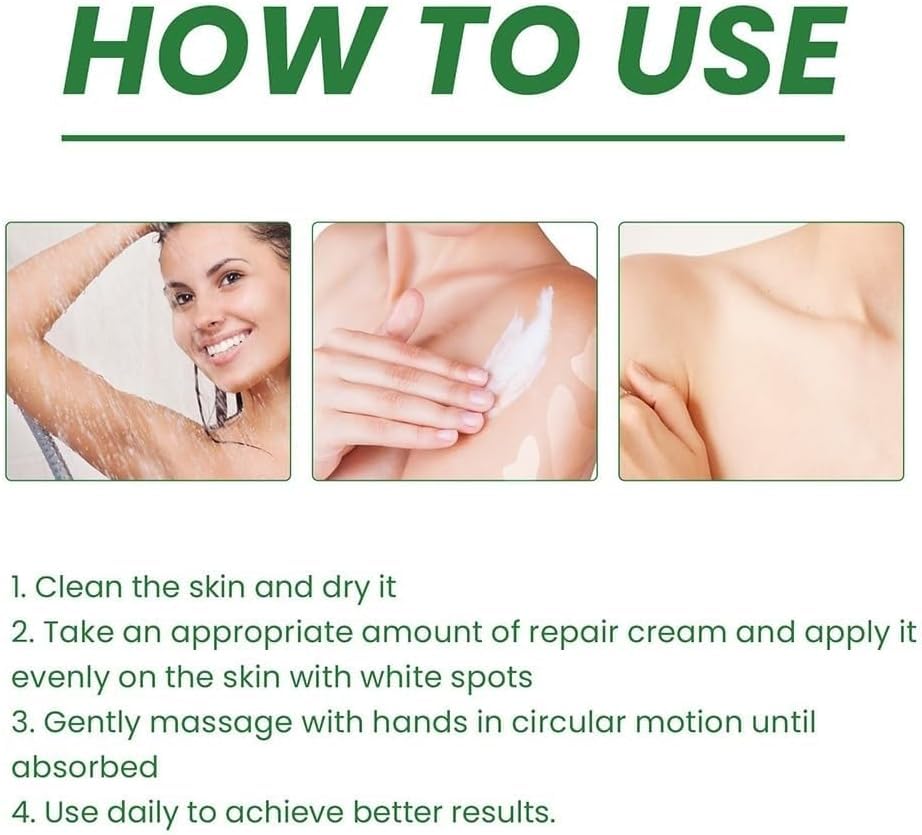 Vitiligo Treatment Cream - White Spot Remover & Skin Pigmentation Corrector | Soothing Moisturizer for Vitiligo Care | Reduces White Patches & Improves Skin Tone (2 Pack) - Ideal for Daily Skincare Routine & Spot Treatment