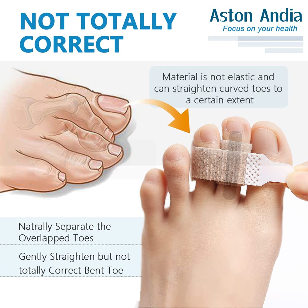 Aston Andia 2-Pack Soft & Comfortable Toe Straighteners for Women - Nylon Toe Separators & Finger Support Bands for Crooked Toes, Hammer Toes Relief - Perfect for Yoga, Running & Daily Comfort