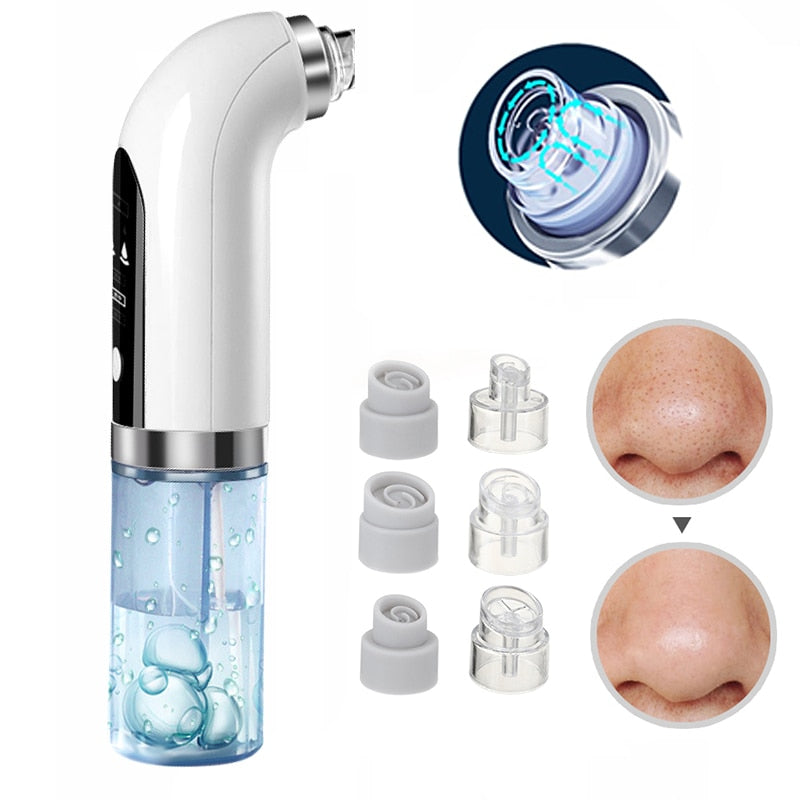 Professional USB-Powered Blackhead Remover Vacuum - Portable Pore Cleaner for Face & Nose - Perfect for Home Spa & Skincare Routine