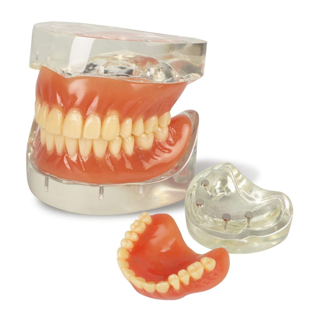 Adult Standard Teeth Demonstration Model with Removable Teeth - Dental Teaching Tool for Students & Professionals | Perfect for Classrooms, Dental Offices & Training Labs