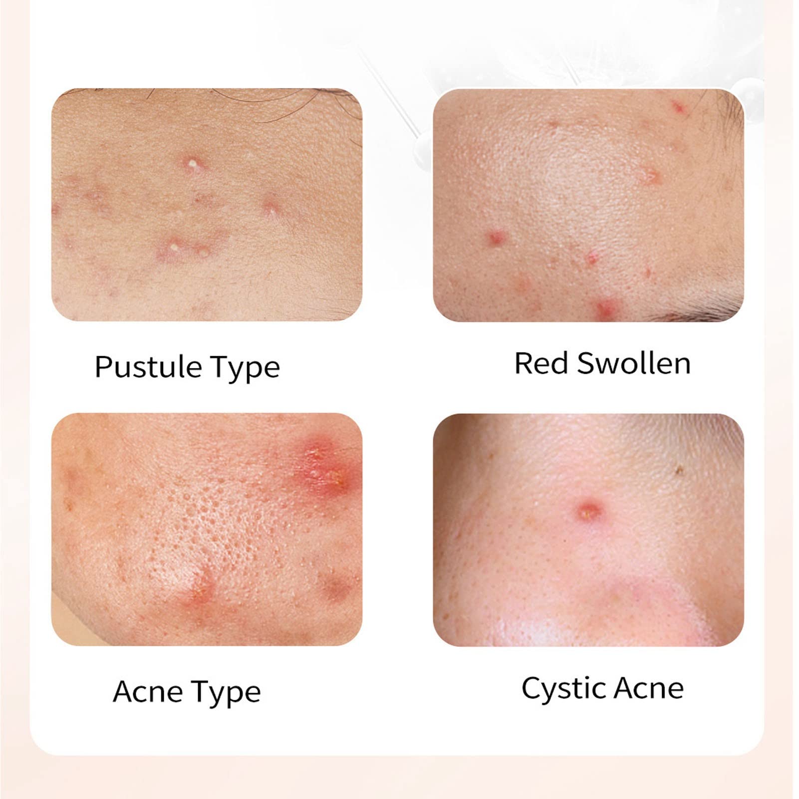 24-Pack Skin-Friendly Breathable Adhesive Pads - Strong Absorption, Waterproof, Stain-Resistant for Daily Skincare & Wound Care