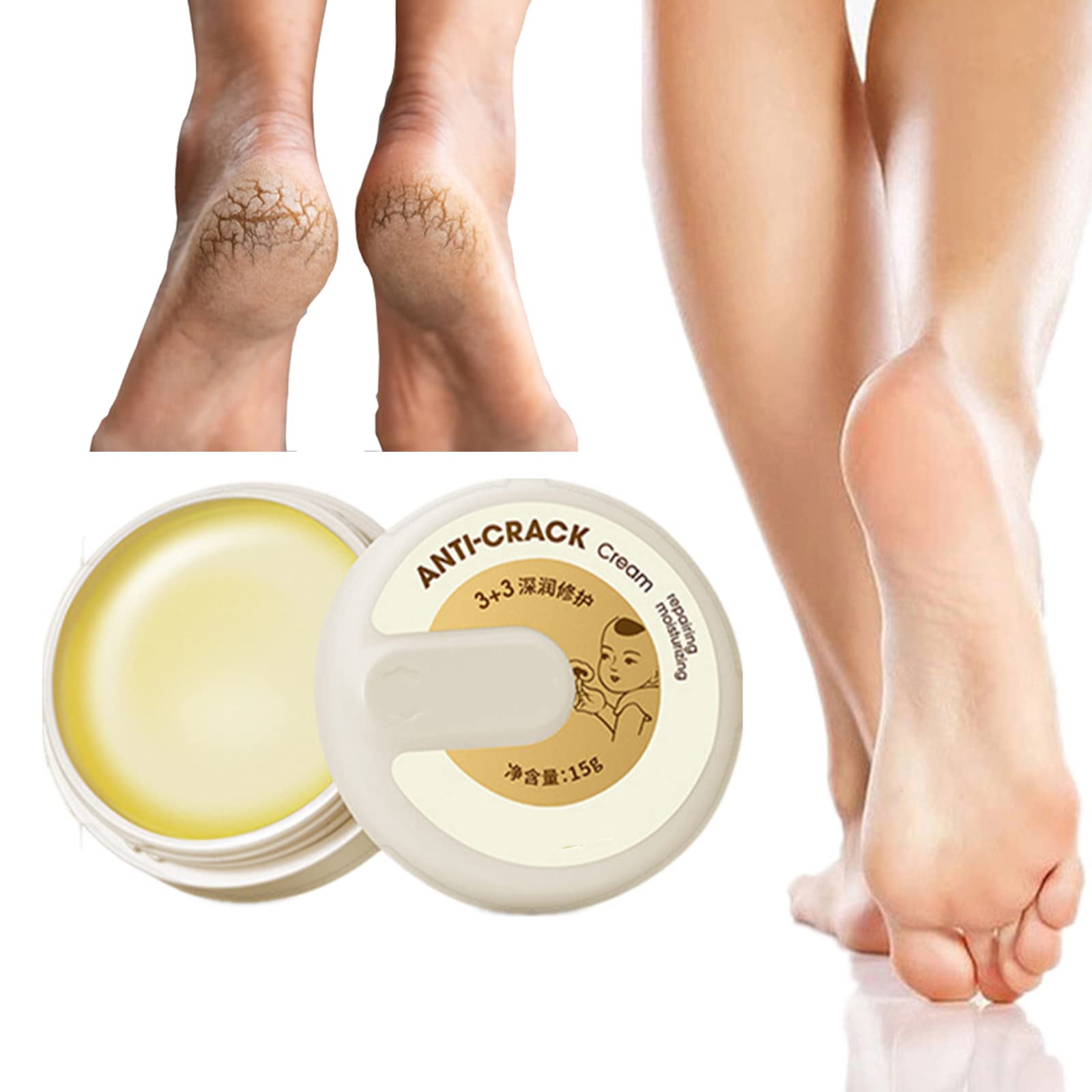 Winter Cracked Skin Repair Cream - Anti Crack Hand & Foot Cream for Dry, Rough, Chapped Skin - Natural Moisturizing Foot Balm (15g, 1/2/3/5Pcs) - Perfect for Winter Care, Overnight Healing & Daily Hand Foot Protection