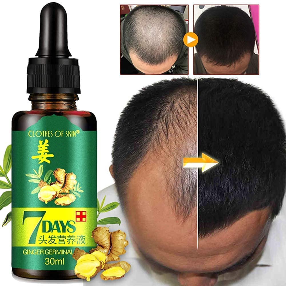 Ginger Essential Oil Hair Growth Serum - 7 Day Hair Regrowth Treatment for Men & Women, 30ml (2 Pack) - Anti Hair Loss & Scalp Care Solution for Thicker, Healthier Hair - Perfect for Daily Use & Nighttime Hair Routine