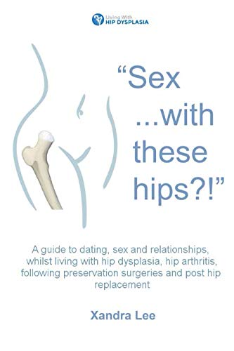 Sex and Dating with Hip Dysplasia: A Guide to Relationships, Intimacy & Life After Hip Replacement Surgery - For Arthritis Patients & Post-Op Recovery