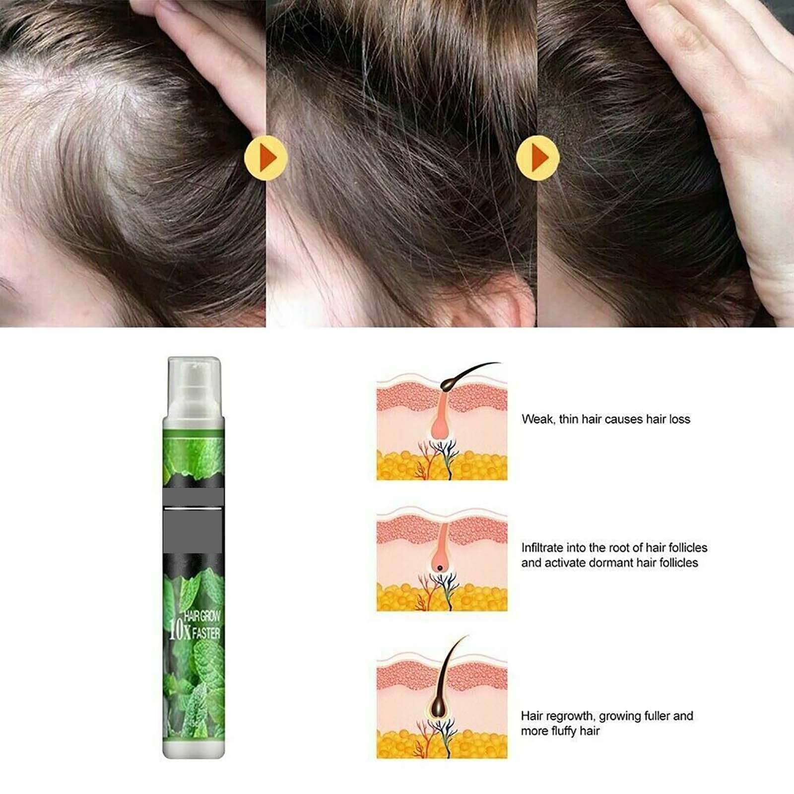 Gokame Hair Growth Serum Spray - Anti Hair Loss, Strengthen & Thicken Hair for Daily Care (2pcs) - Home & Salon Use