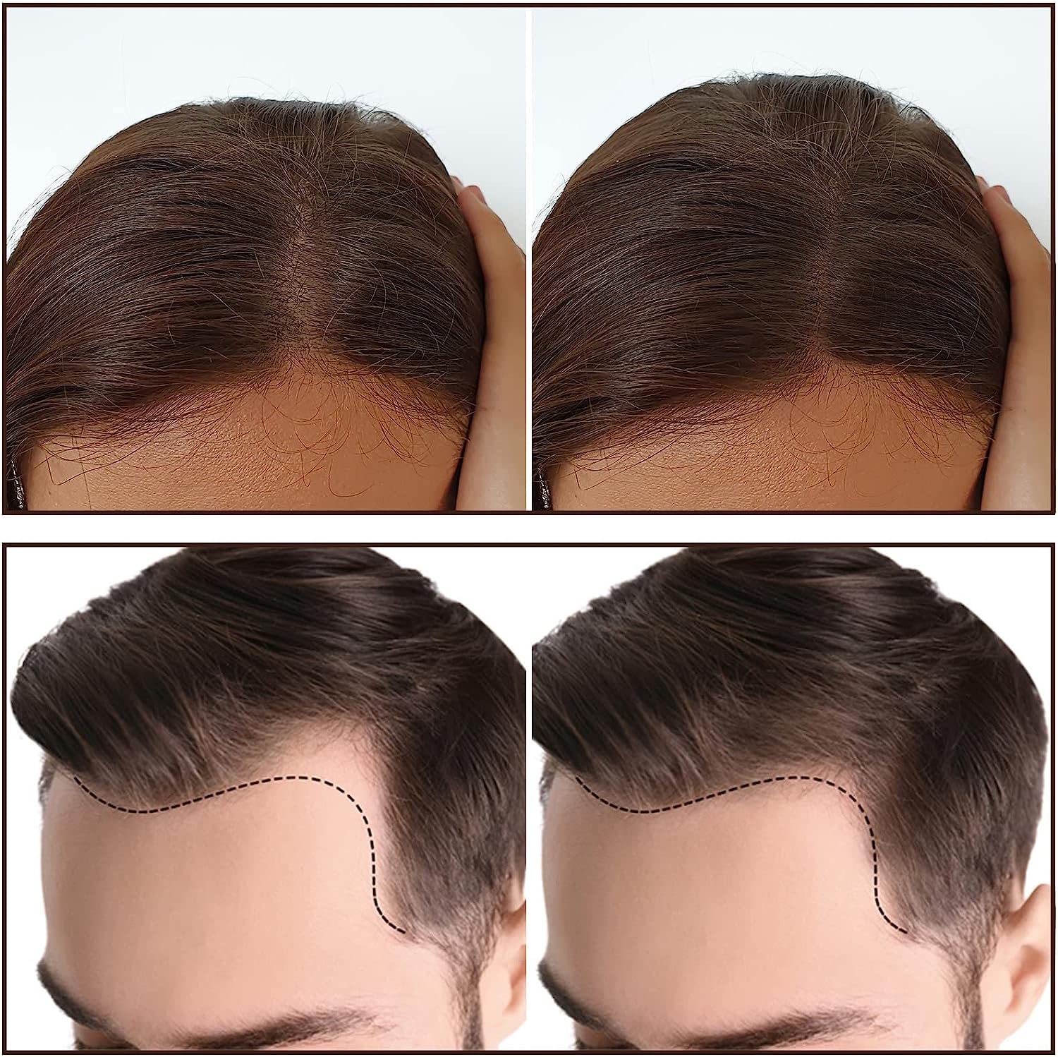 VBA Hair Shadow Powder & Hairline Powder Stick - Thinning Hair Concealer for Hair Loss, Root Touch-Up Powder to Cover Bald Spots & Hair Fall (Black, 178g) - Perfect for Daily Use, Travel & Quick Hairline Fixes
