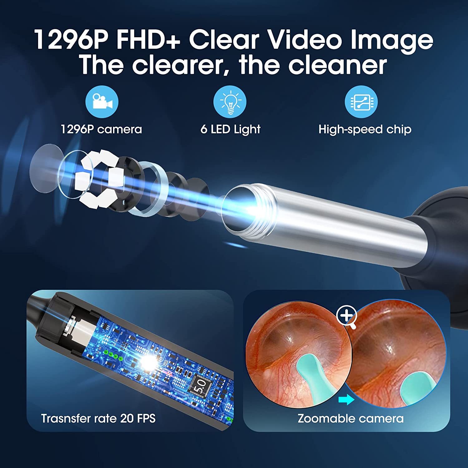 Ear Wax Removal Tool with HD Camera - Safe & Effective Ear Cleaner for Adults & Kids - Home Use & Professional Ear Cleaning Kit
