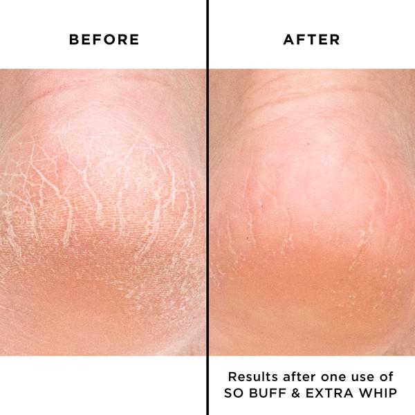 Butter London Extra Whip Hand and Foot Treatment with Shea Butter - Hydrating Moisturizer for Dry Skin - Perfect for Spa Day & Home Nail Care