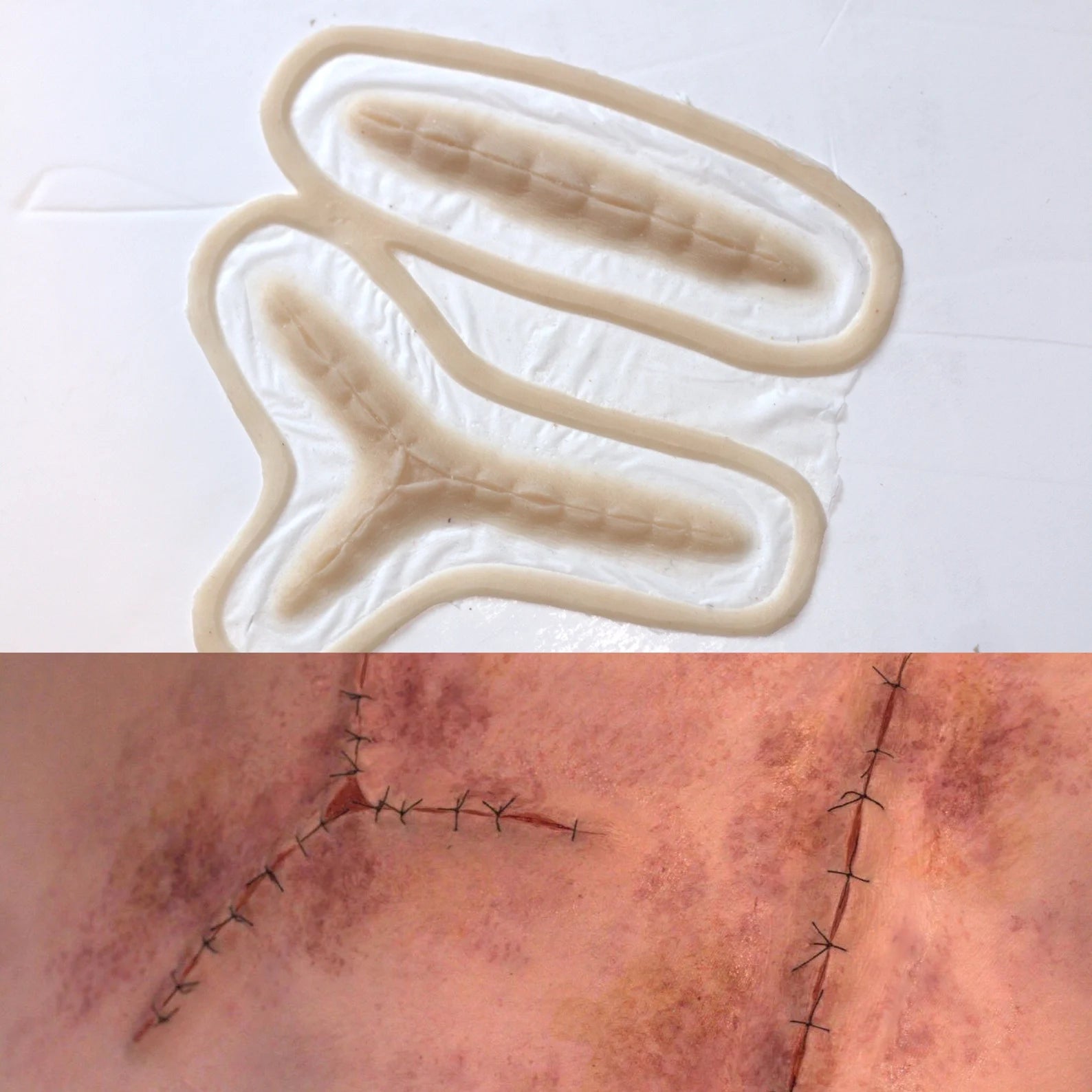 Obsidian FX Realistic Stitched Wound Prosthetic Set (2 Piece) - Perfect for Halloween, Cosplay & Special Effects Makeup