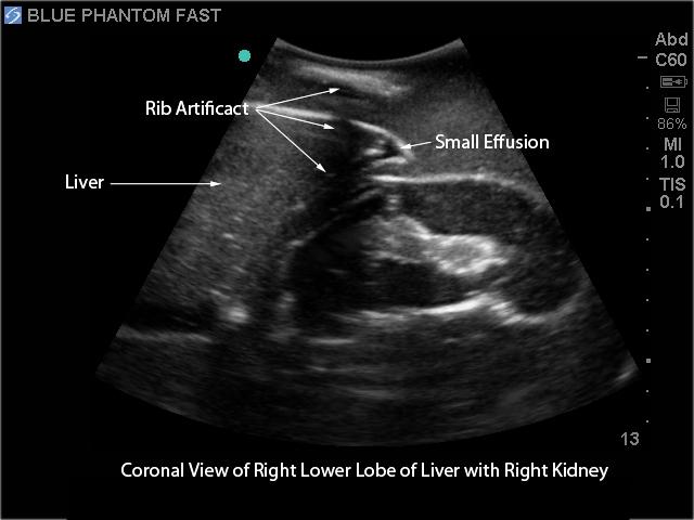 FAST Exam Real Time Ultrasound Training Model - Transthoracic Only for Emergency Medicine & Trauma Assessment Practice (Medical Simulation, Sonography Education, TTE Training)