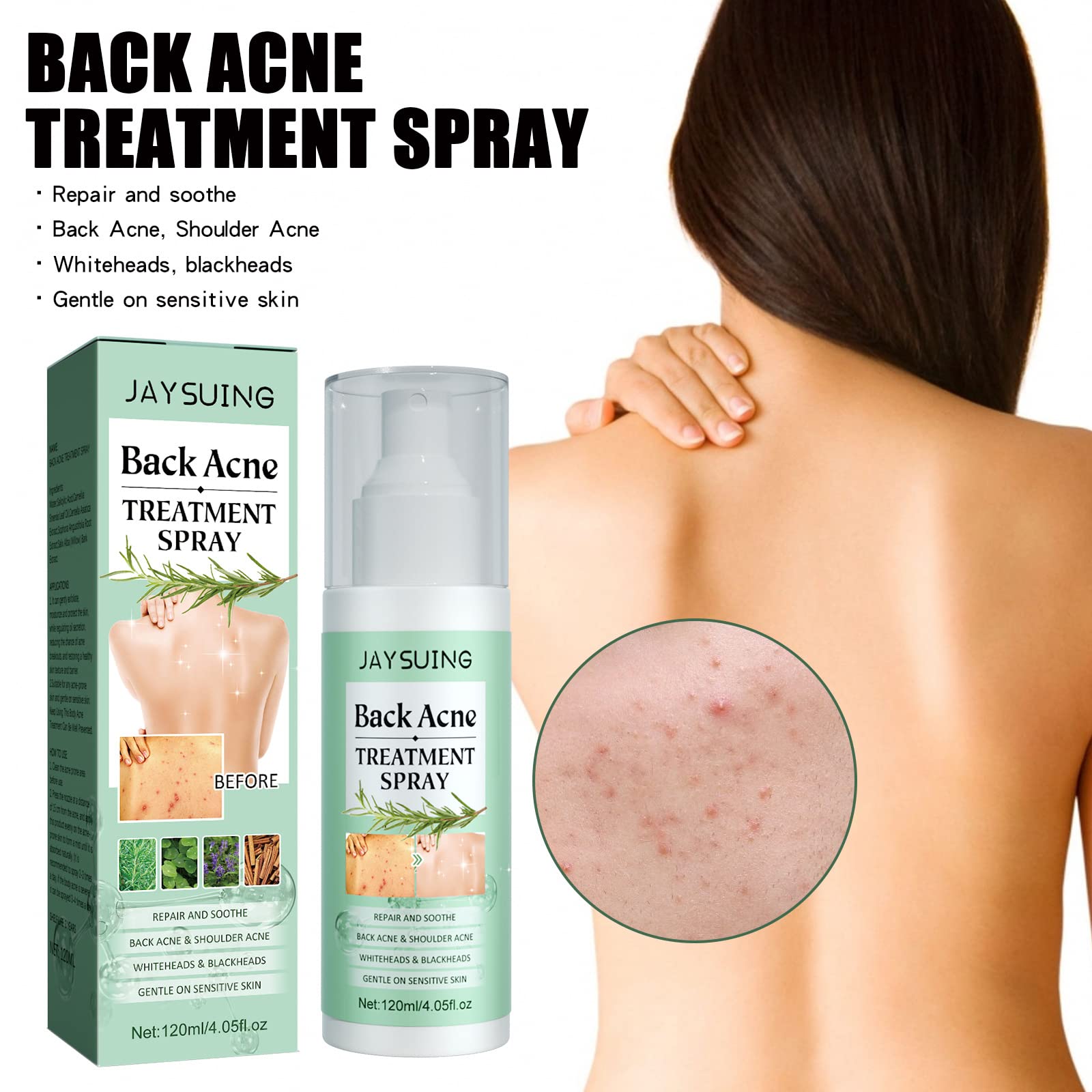 2% Salicylic Acid Back Acne Spray Treatment with Tea Tree Oil & Herbal Formula - 4.05 oz Acne Solution for Teens & Adults | Clear Body Breakouts for Gym, Sports & Daily Use