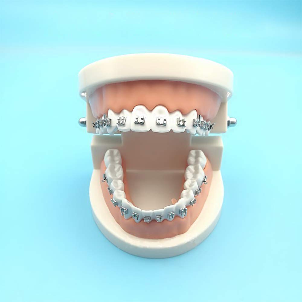 1:1 Dental Orthodontic Teeth Model with Metal Braces - Patient Education & Teaching Tool for Dentists - Perfect for Dental Offices, Schools & Orthodontic Clinics