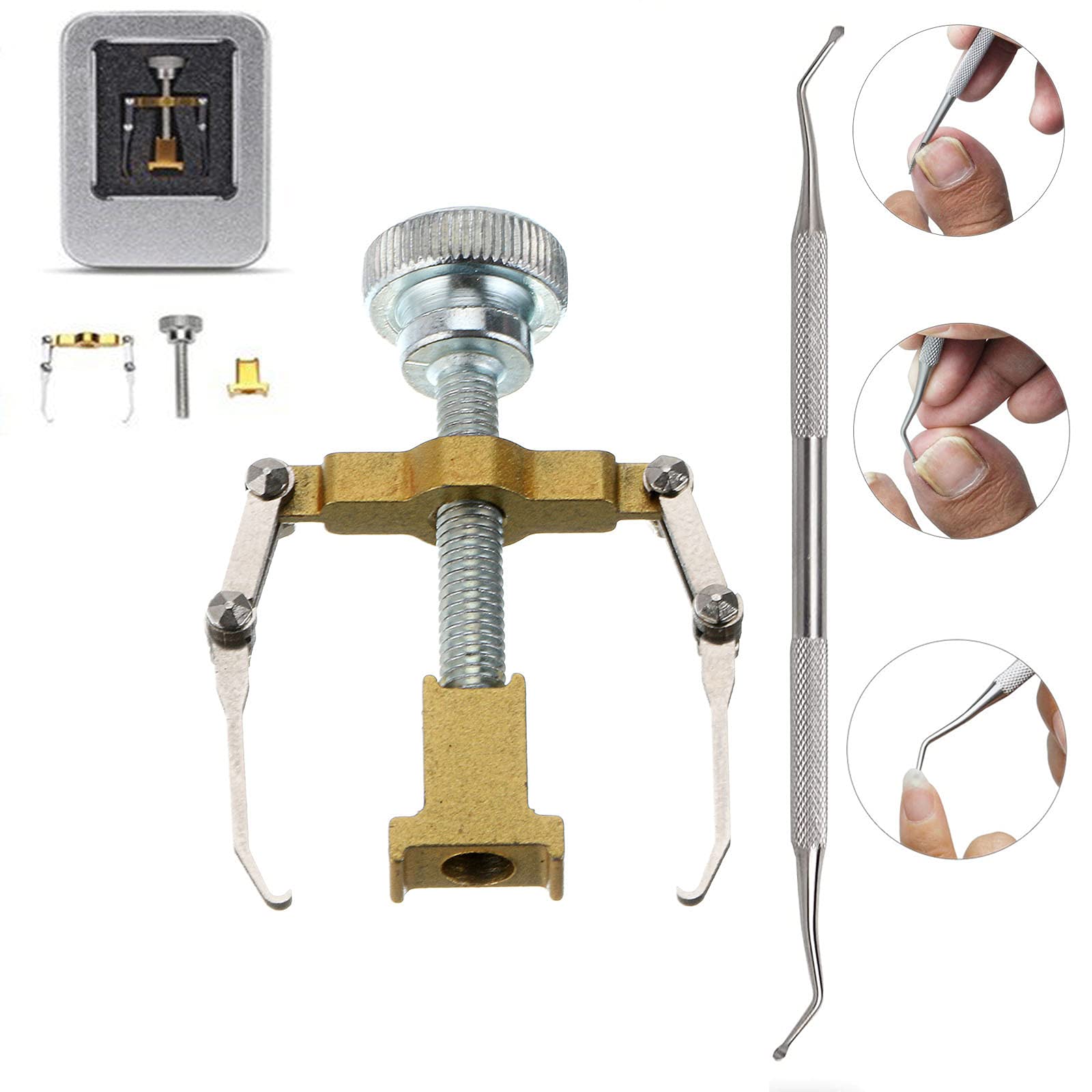 Ingrown Toenail Corrector & Pedicure Tool - Double Sided Nail Lifter for Toenail Care, Orthotic Nail Fixer - Perfect for Ingrown Toenail Treatment & At-Home Pedicures