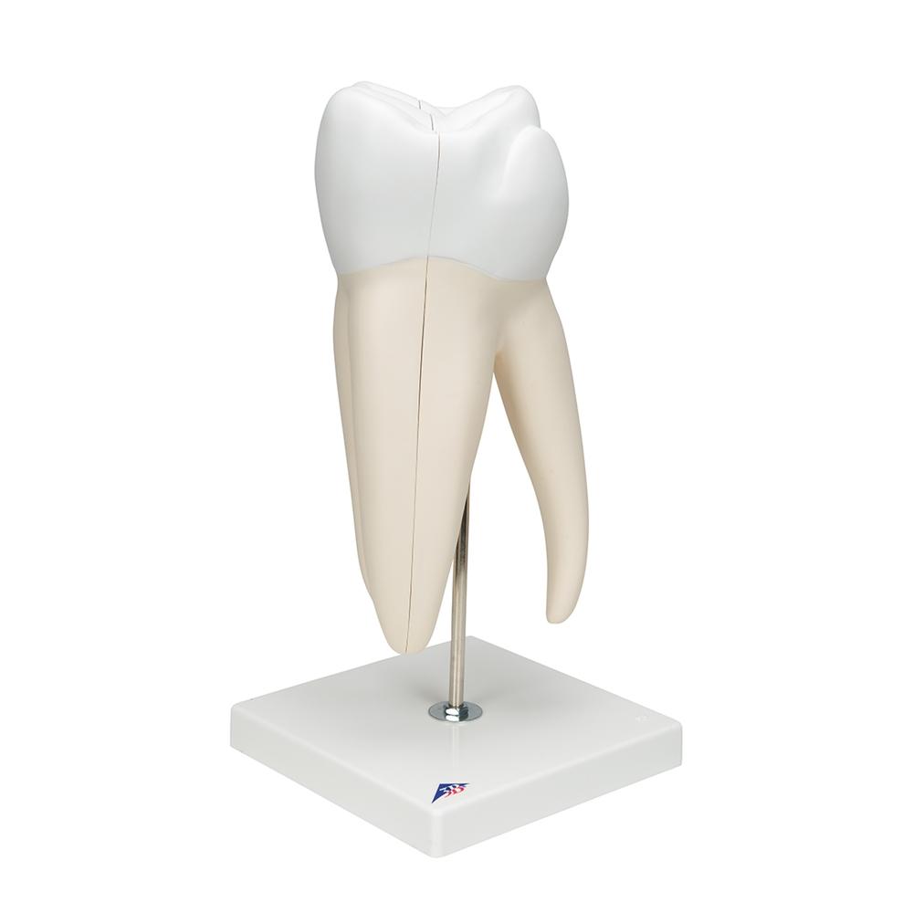 Giant Molar with Cavities - 15x Life Size Dental Model (5-Part) - Perfect for Dental Education, Classroom Demonstrations & Medical Training