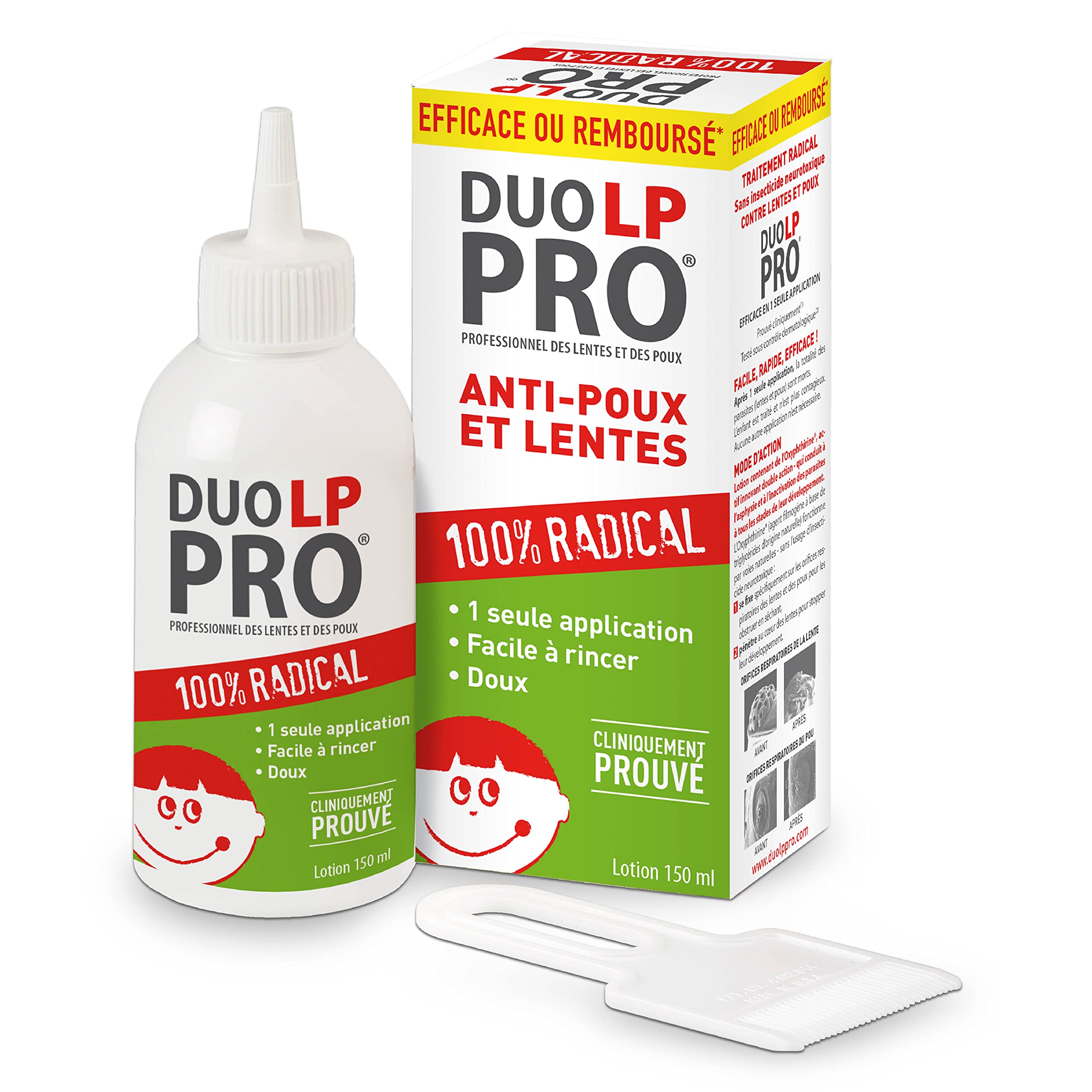 Duo LP-Pro Radical Lotion for Nits and Lice Treatment - 150ml | Fast-Acting Head Lice Solution for Kids & Adults | Home & School Use