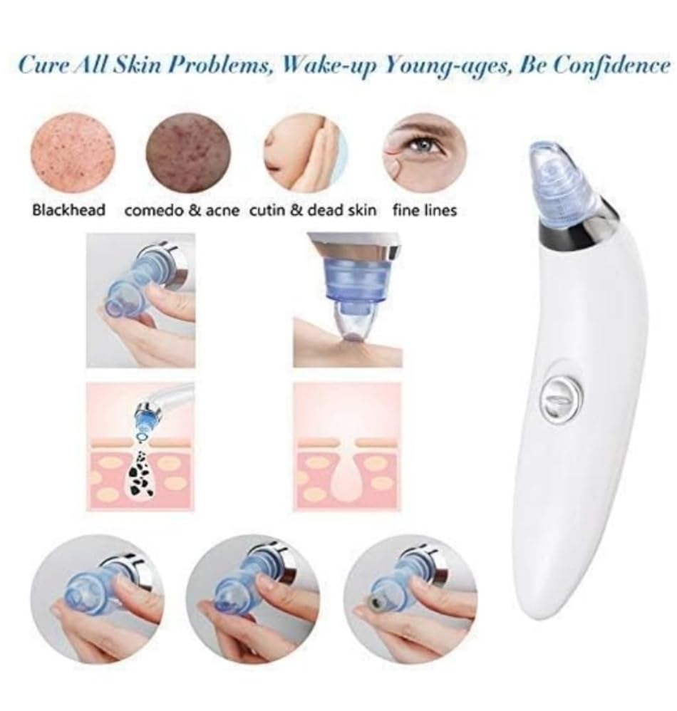 Blackhead Remover Vacuum Kit - 4-in-1 Multi-Function Pore Cleaner for Acne & Pimple Removal, Skin Care Tool for Beautiful Complexion (White) | Perfect for Daily Facial Cleansing & Spa Treatments