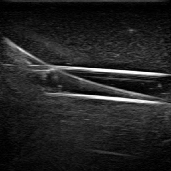Gen II PICC with IV & Arterial Line Vascular Access Ultrasound Trainer - Medical Simulation for Ultrasound Guided PICC Insertion, X-Ray Positioning Practice & IV Therapy Training