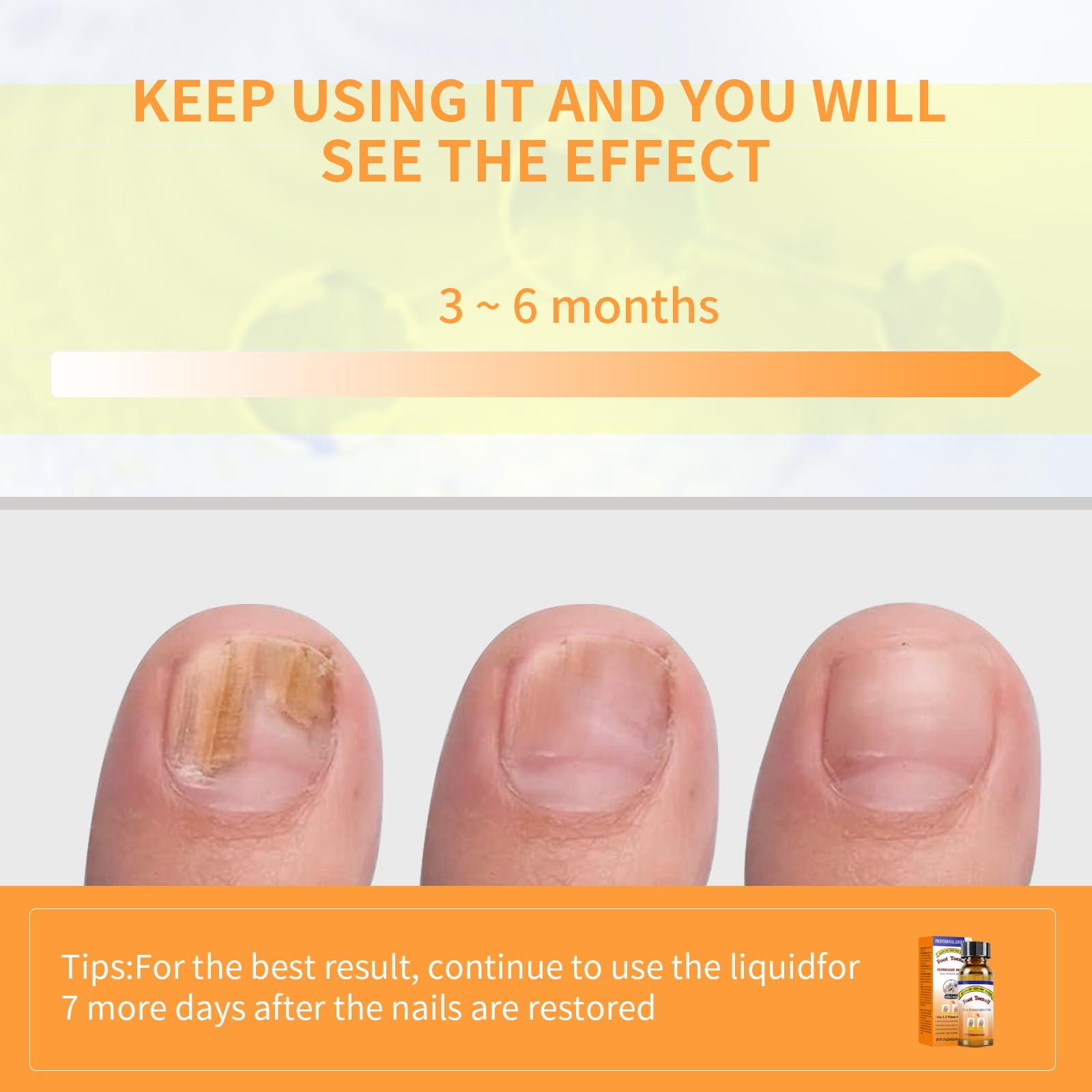 Extra Strength Toenail Fungus Treatment Fluid with Soft Brush Head - 30ML for Fast & Effective Nail Fungus Removal | Home Foot Care Solution for Athletes, Swimmers & Daily Use